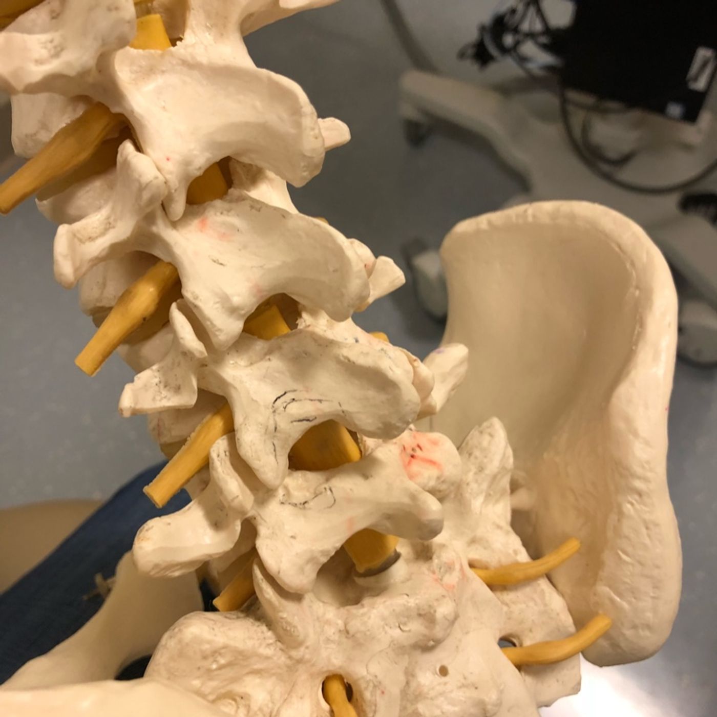 E02 My Backstory (Back Surgery Series)