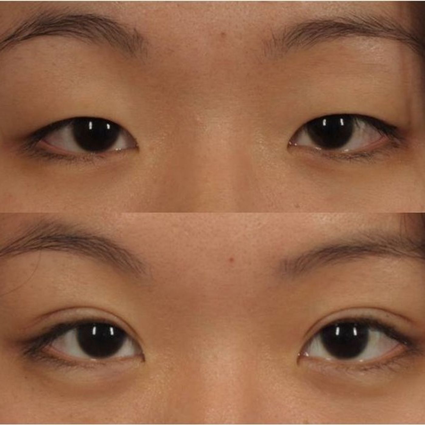 Plastic Surgery & Beauty In South Korea