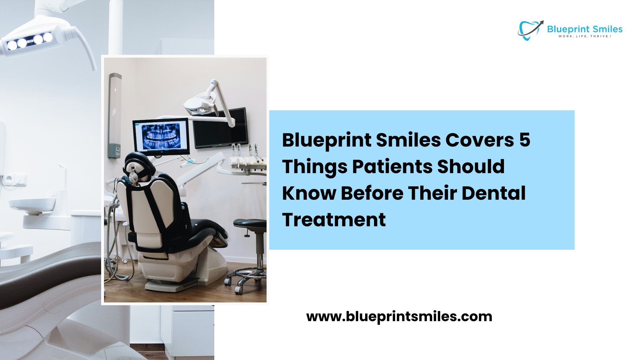 Blueprint Smiles Covers 5 Things Patients Should Know Before Their Dental Treatment