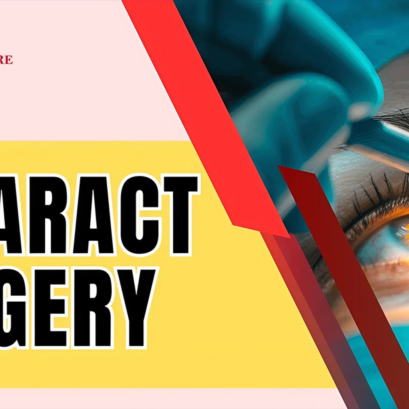 Can Refractive Errors Be Prevented?