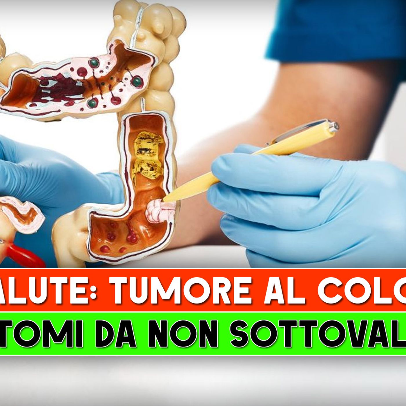Tumore al Colon: 5 Sintomi Da Non Sottovalutare! episode artwork