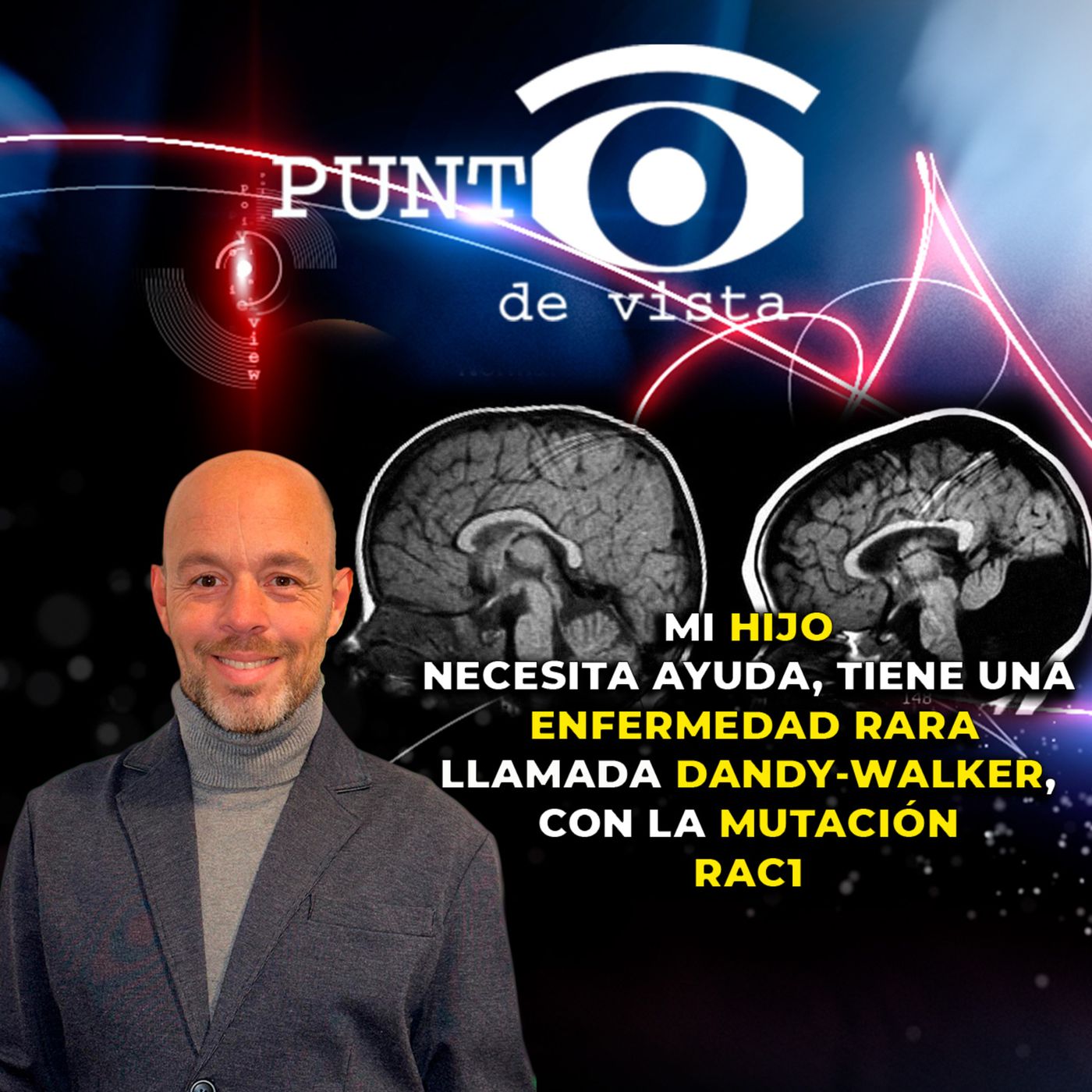 Canal Total TV