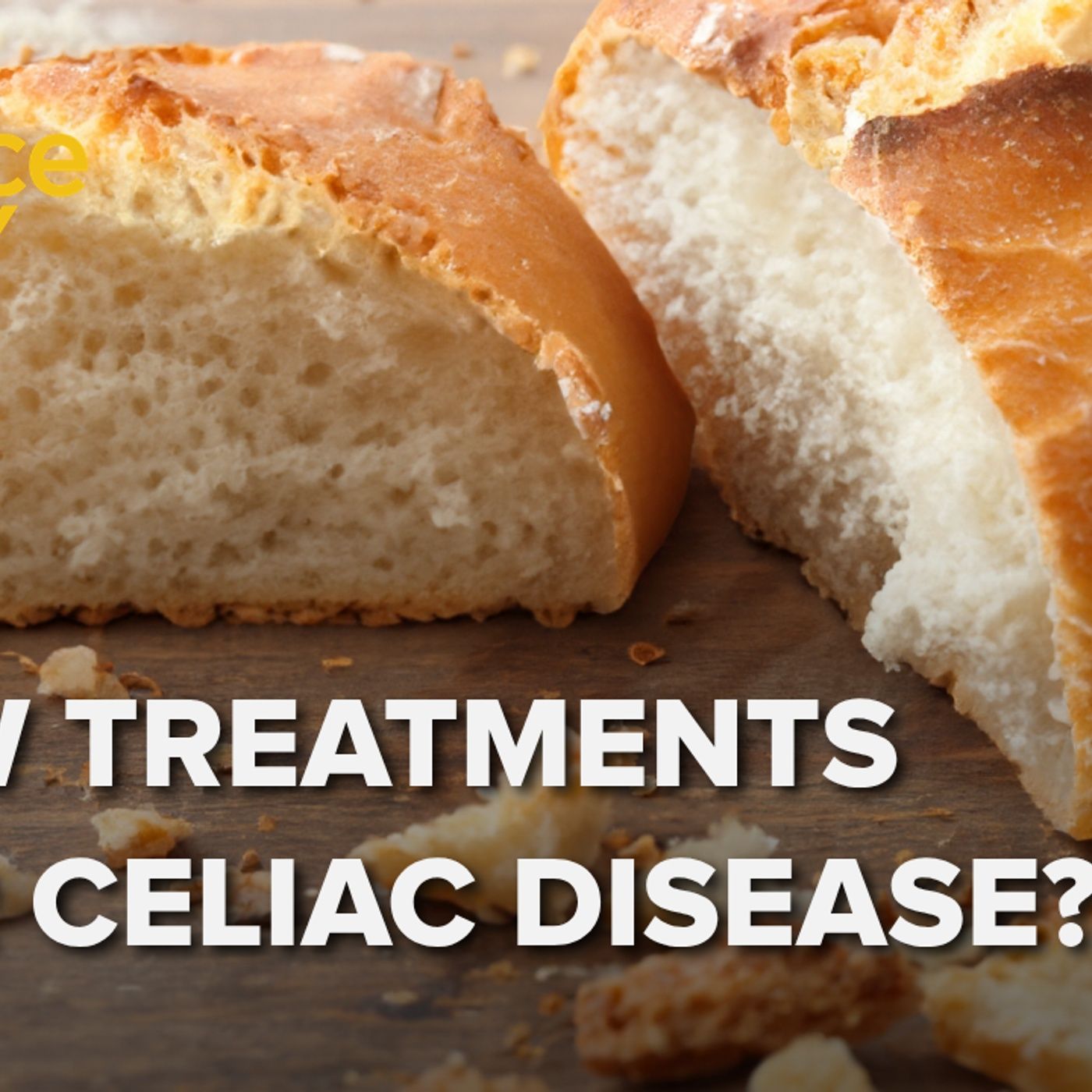 1402: Are new treatments for celiac disease on the horizon?