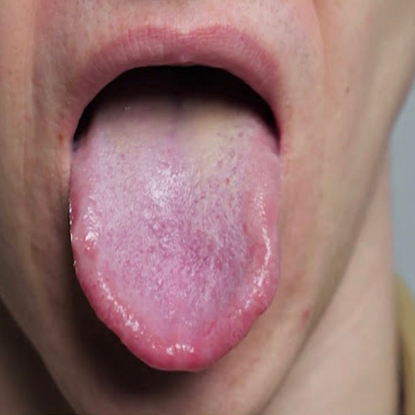 S90E6: It Is Quite A Sizeable Part Of Our Mouth - Trevor Gear On The Power Of The Human Tongue