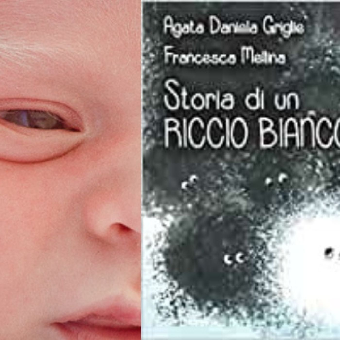 Nero su bianco  - storie di albinismo