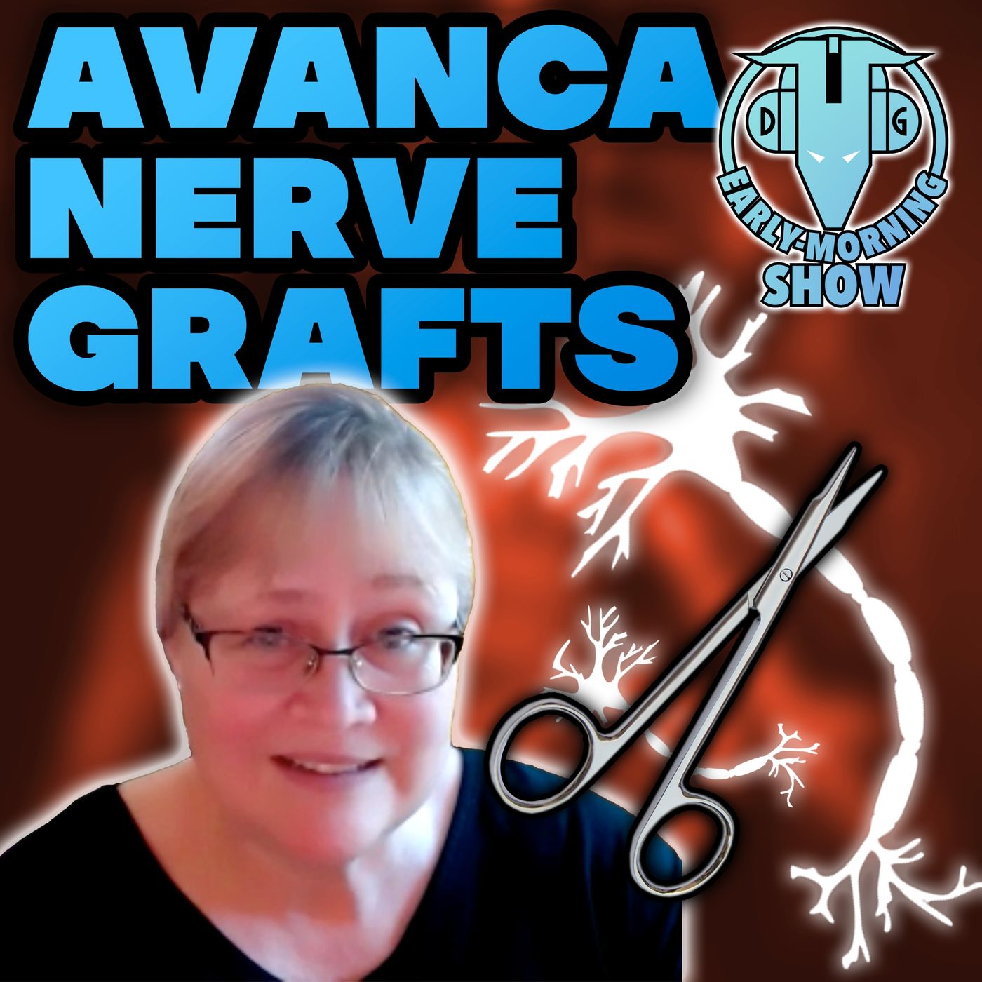 DG Early-Morning Show