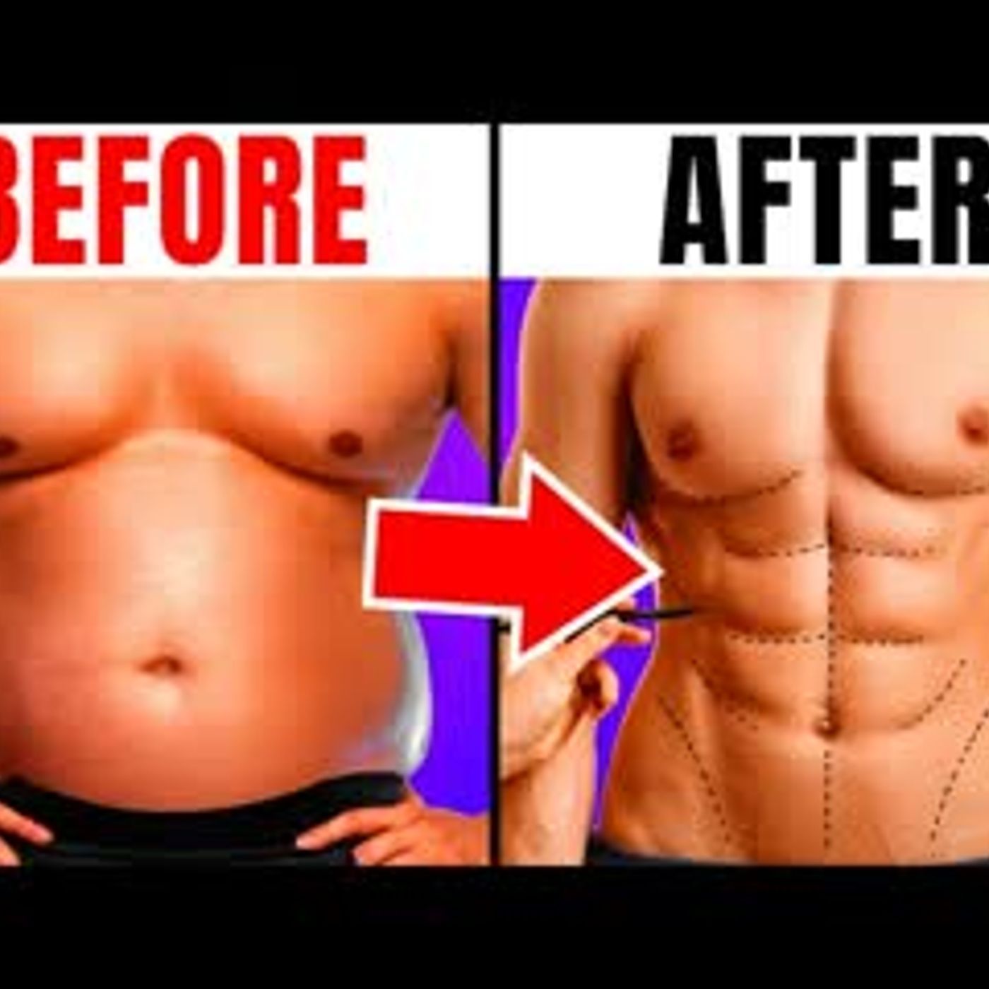 10 Bizarre But Popular Plastic Surgery Procedures You Didn’t Know Existed episode artwork