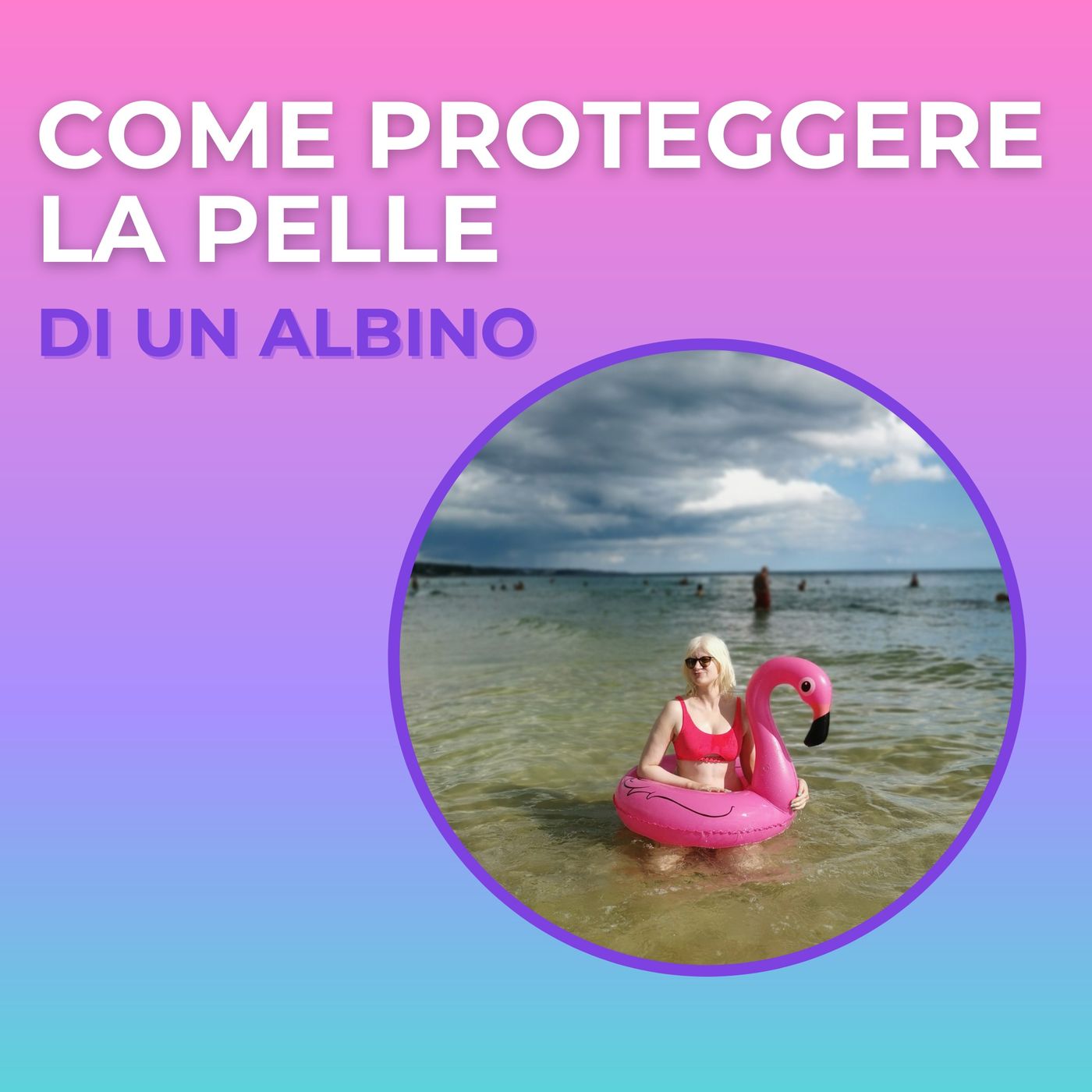 Nero su bianco  - storie di albinismo