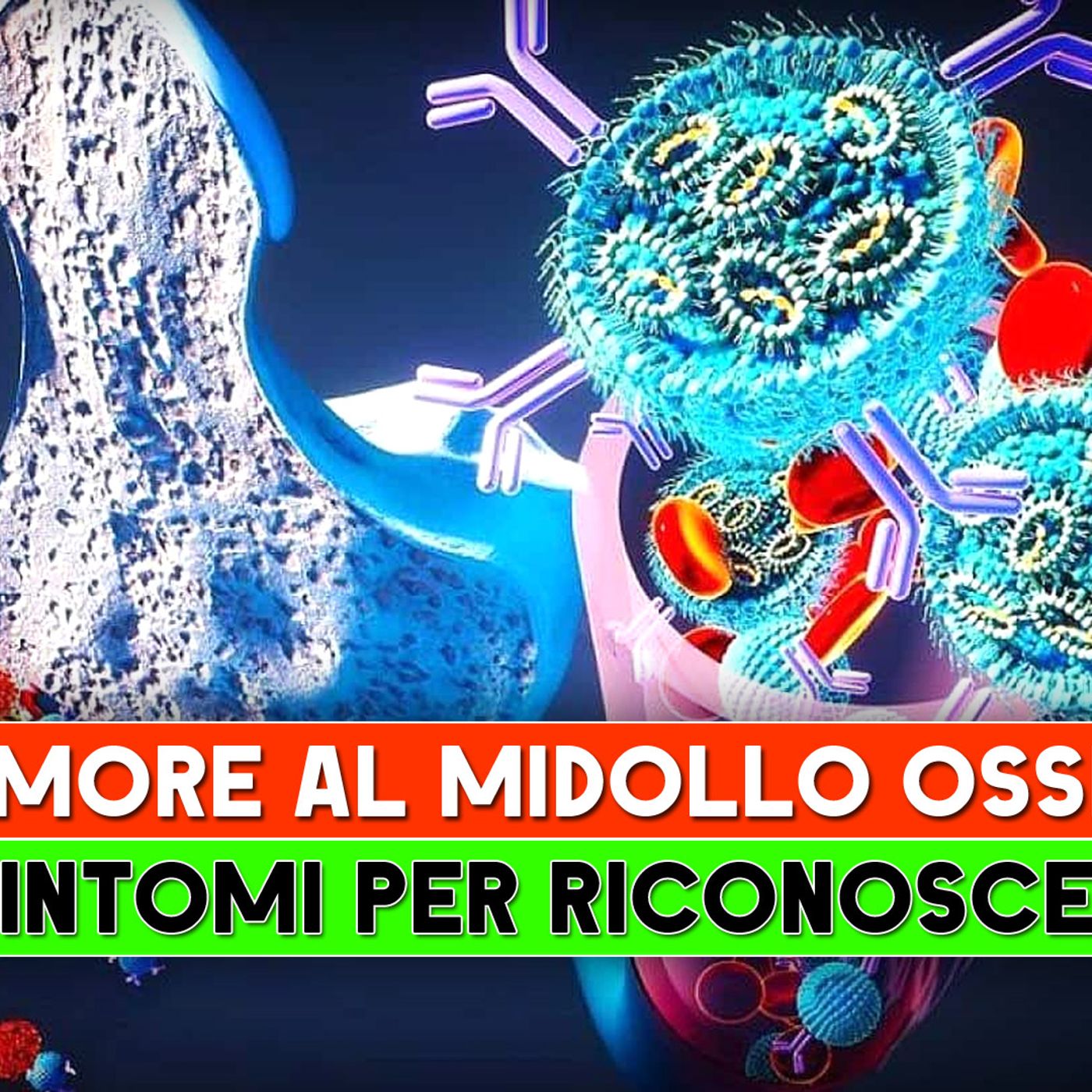 Tumore Al Midollo Osseo: I 7 Sintomi Per Riconoscerlo! episode artwork