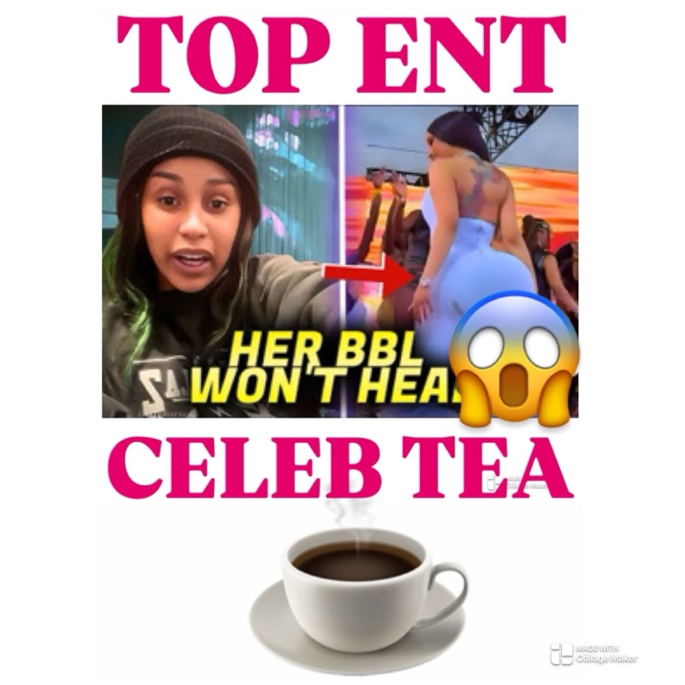 Episode 367 - TopEntNews Vlog ™️”Cardi B SUES Doctor After : Botched BBL Starts Leaking?”
