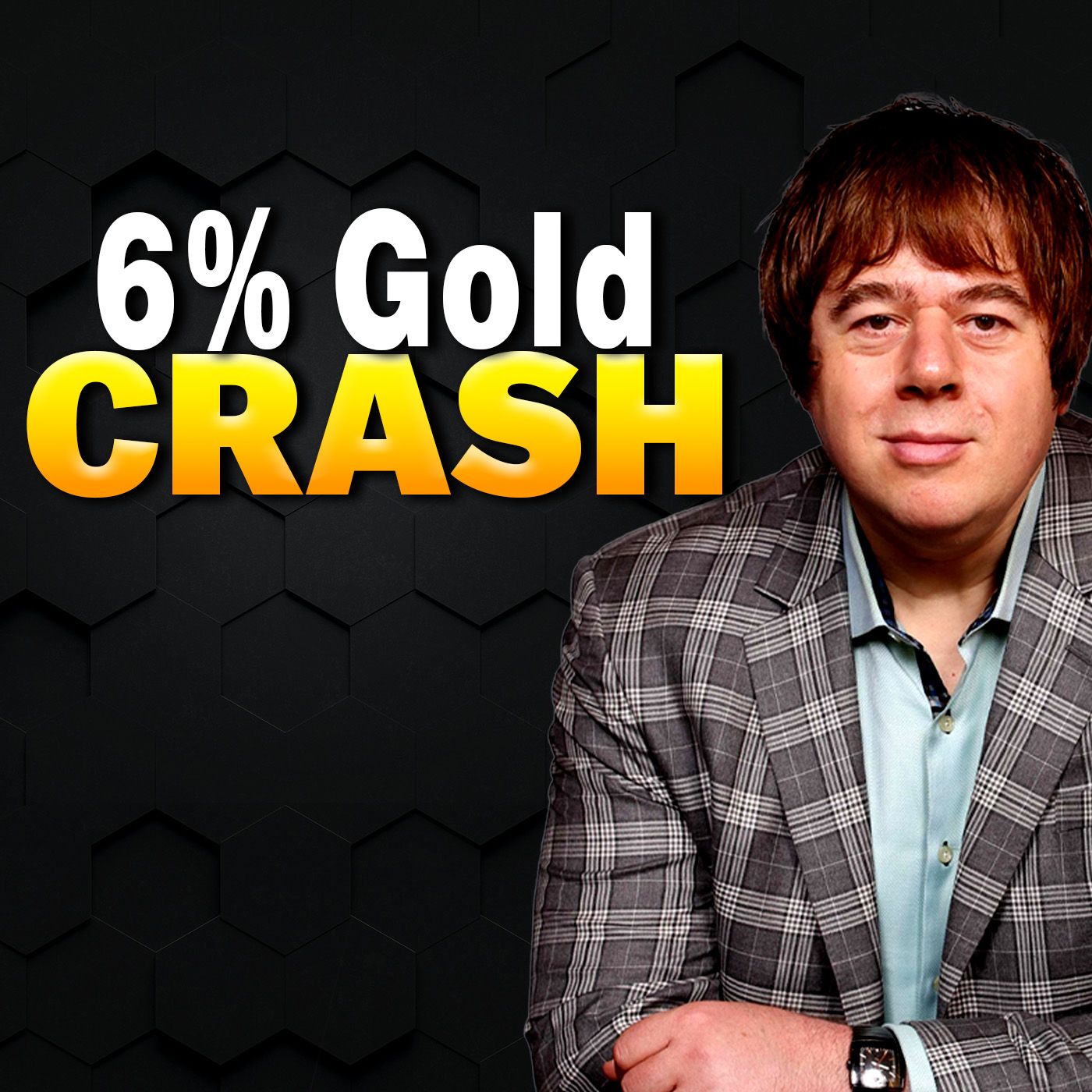 Gold Didn’t Fall — The Dollar Just Spiked (Here’s What’s Really Happening)