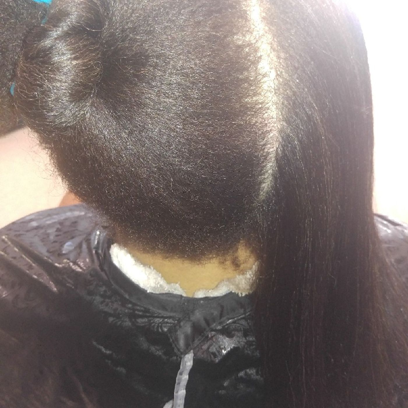 Part#2 Of Hair Growth With Results episode artwork