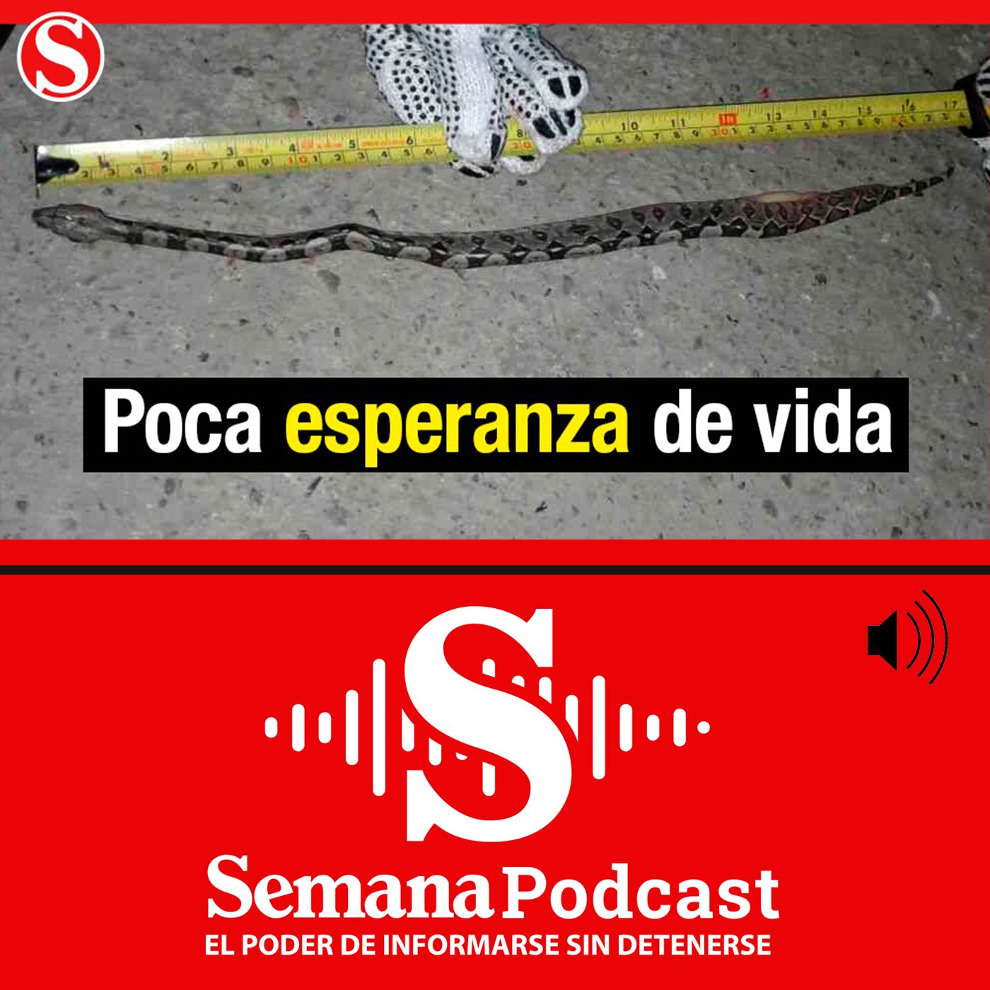 Las pequeñas boas que podrían morir en el parque Simón Bolívar episode artwork