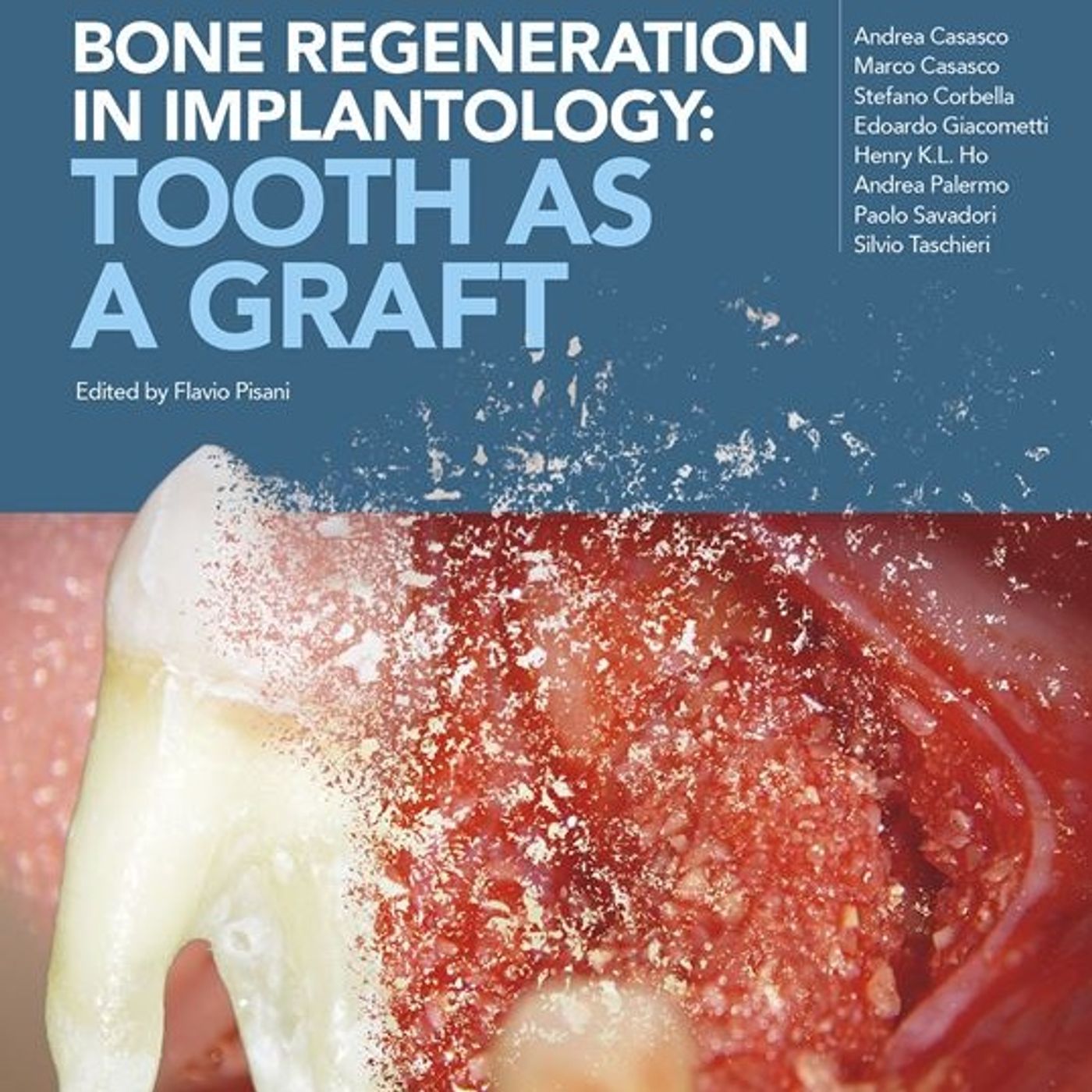 BONE REGENERATION IN IMPLANTOLOGY: TOOTH AS A GRAFT