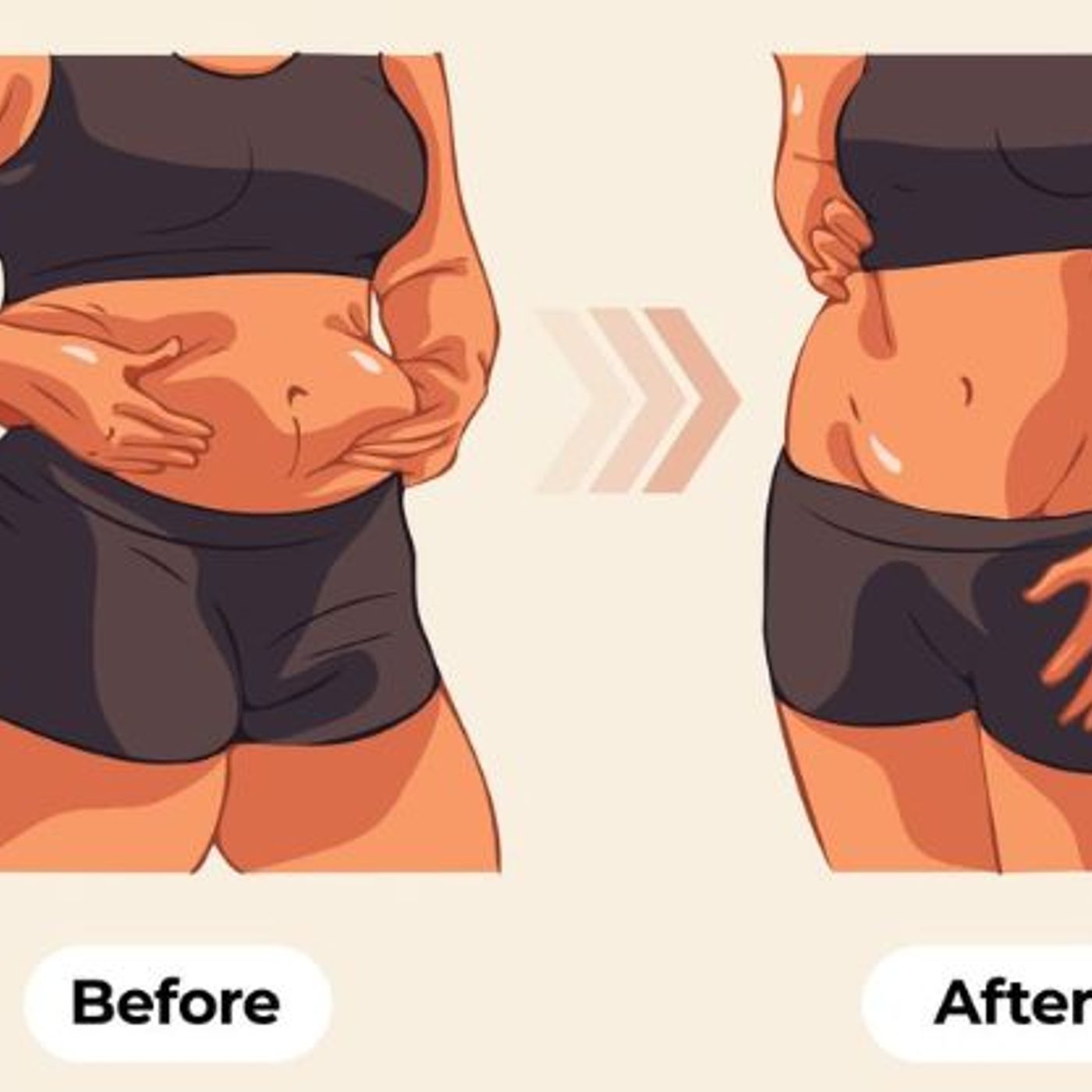 A Complete Guide to Tummy Tuck Surgery podcast artwork