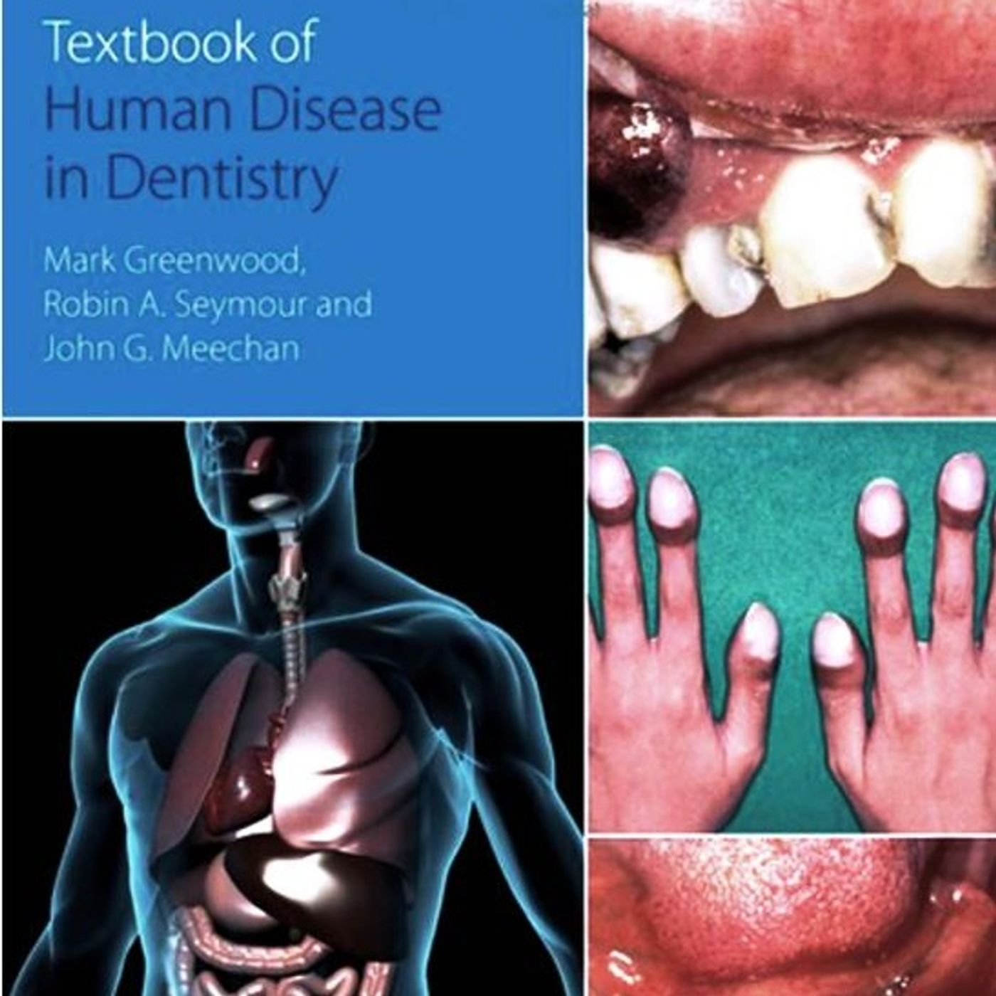 Textbook of Human Disease in Dentistry