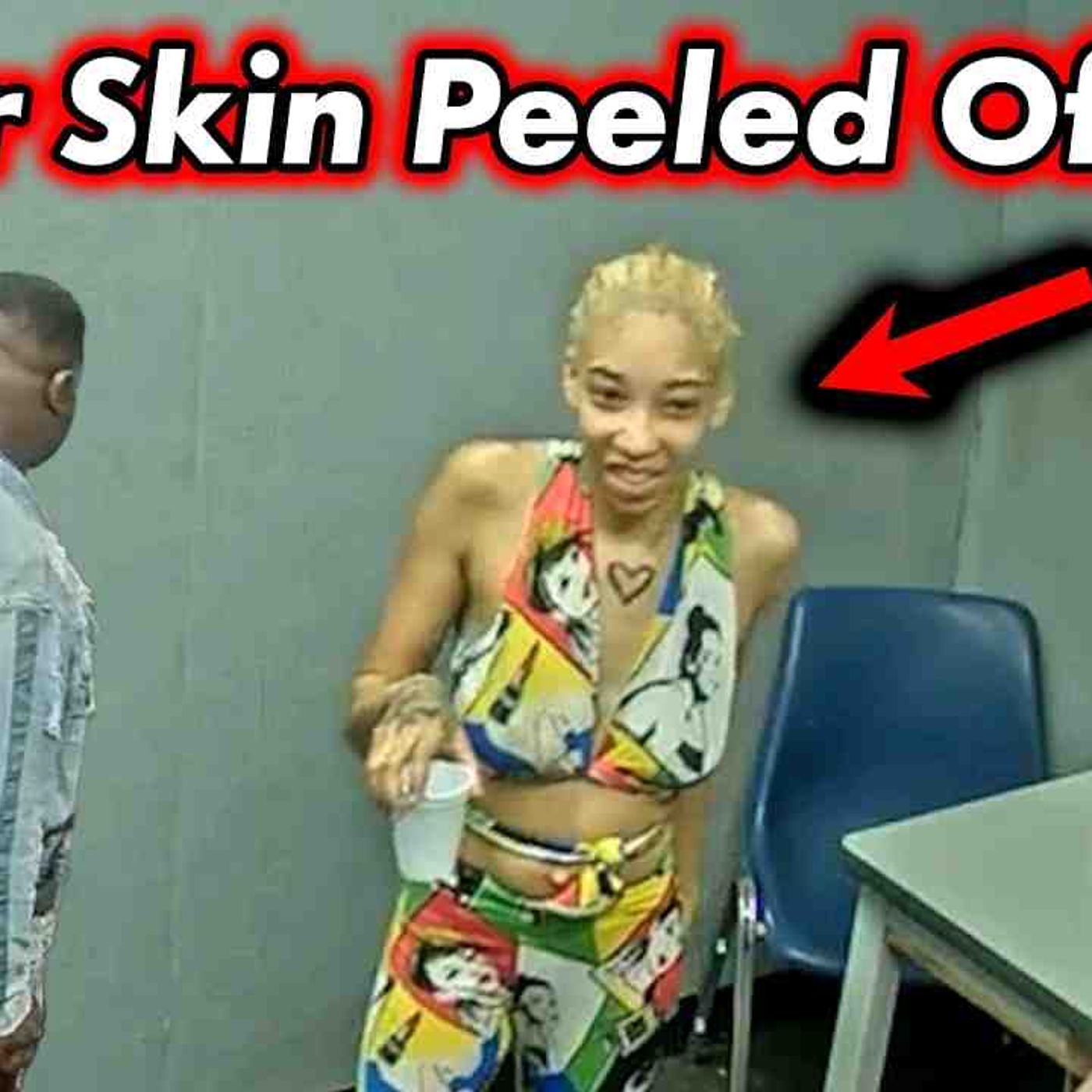 Meth Parents Asked Why Their Child_s Skin Is Peeling Off episode artwork
