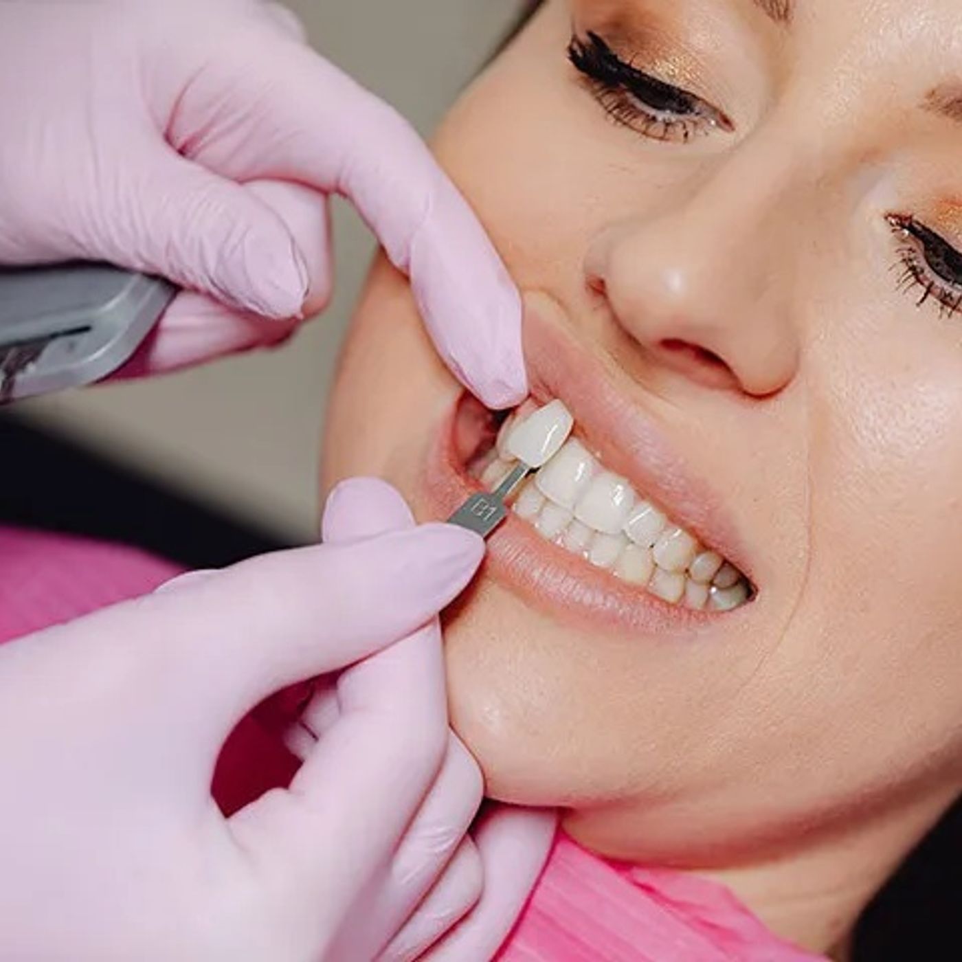 2 Front Teeth Veneers Cost Everything You Need to Know episode artwork