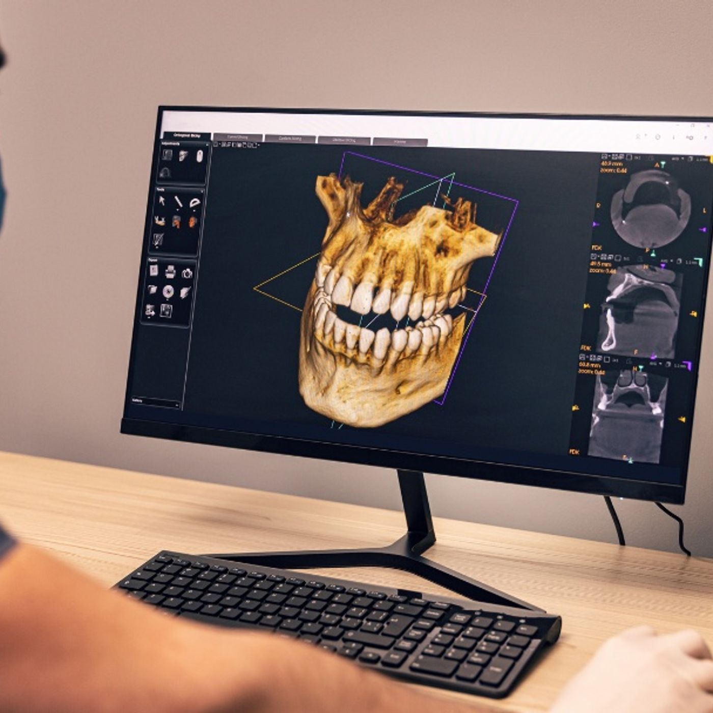 Tecnologías emergentes en la odontología