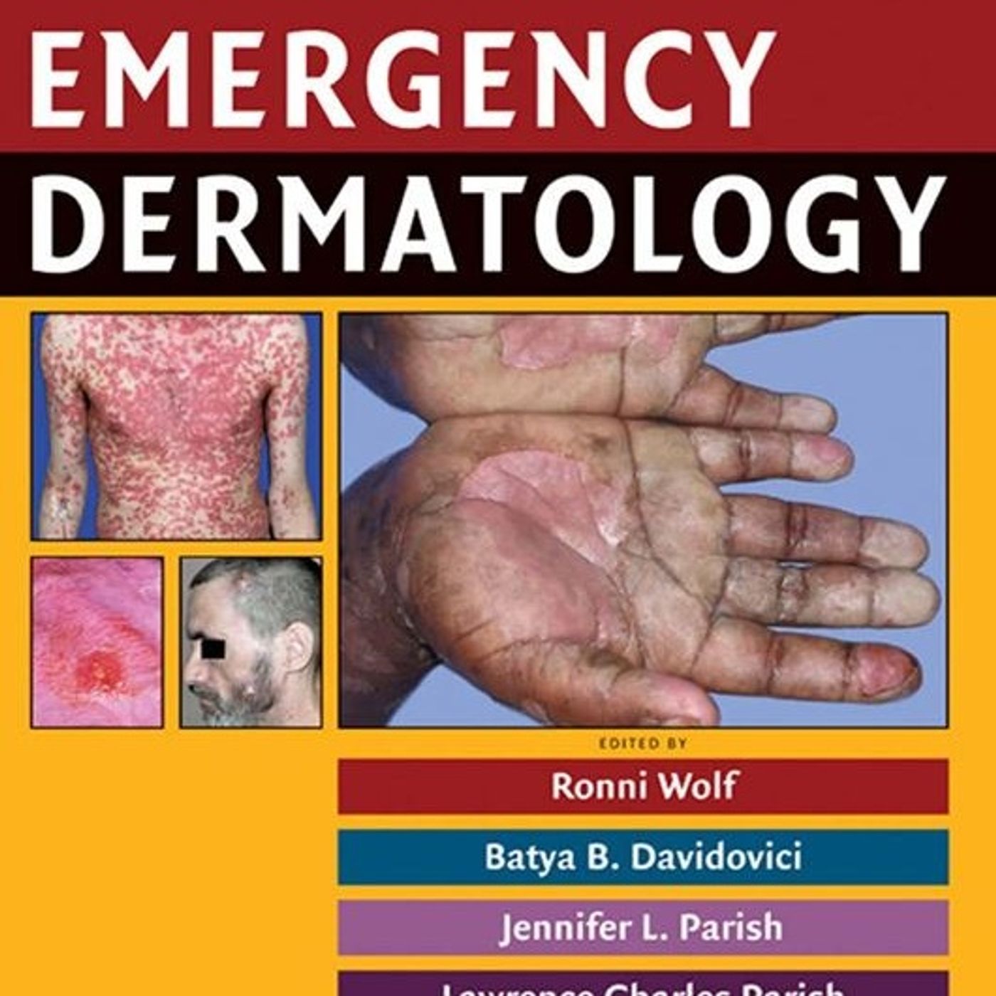 Emergency Dermatology