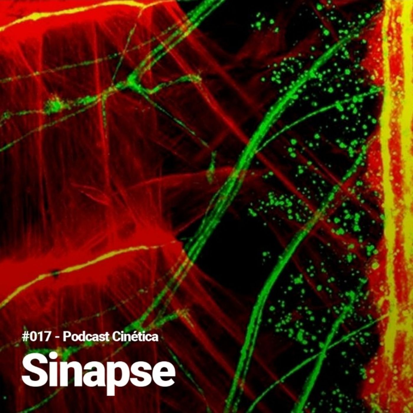 #017 Sinapse