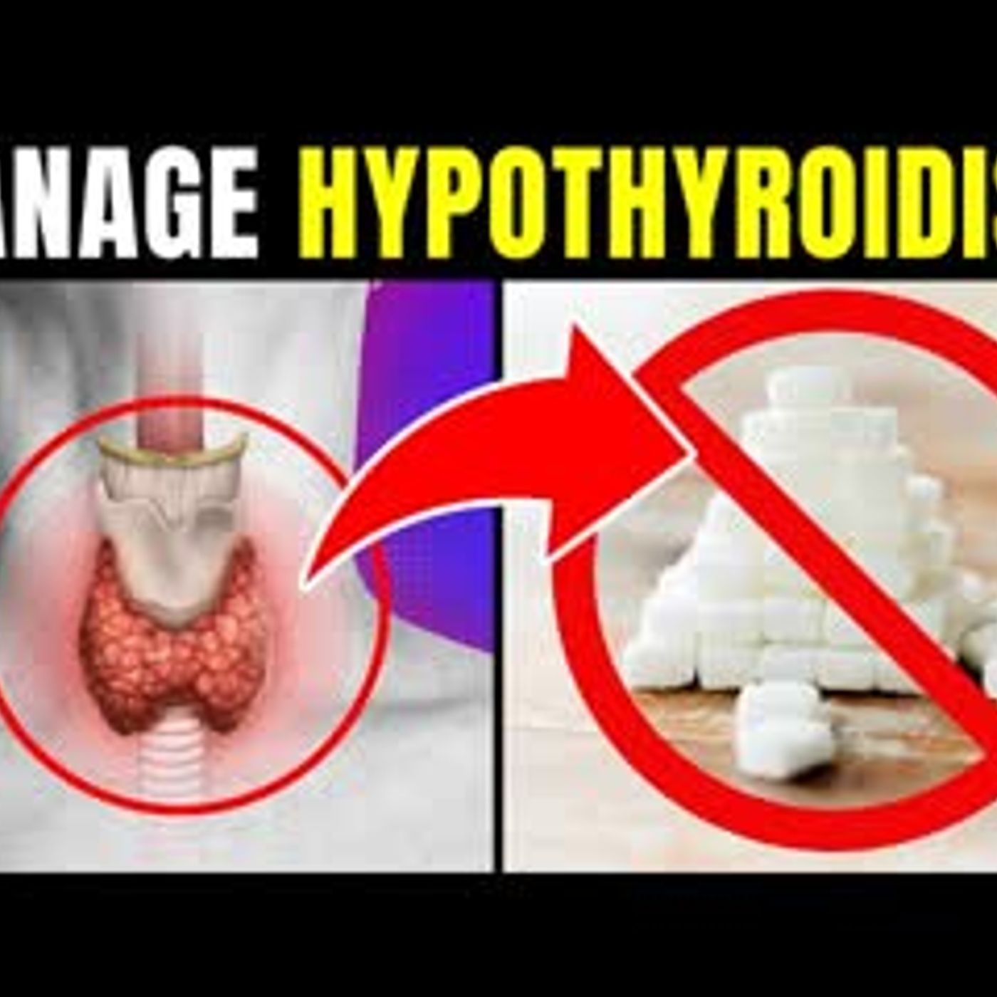 10 Natural Ways To Manage Your Hypothyroidism For Better Overall Health episode artwork