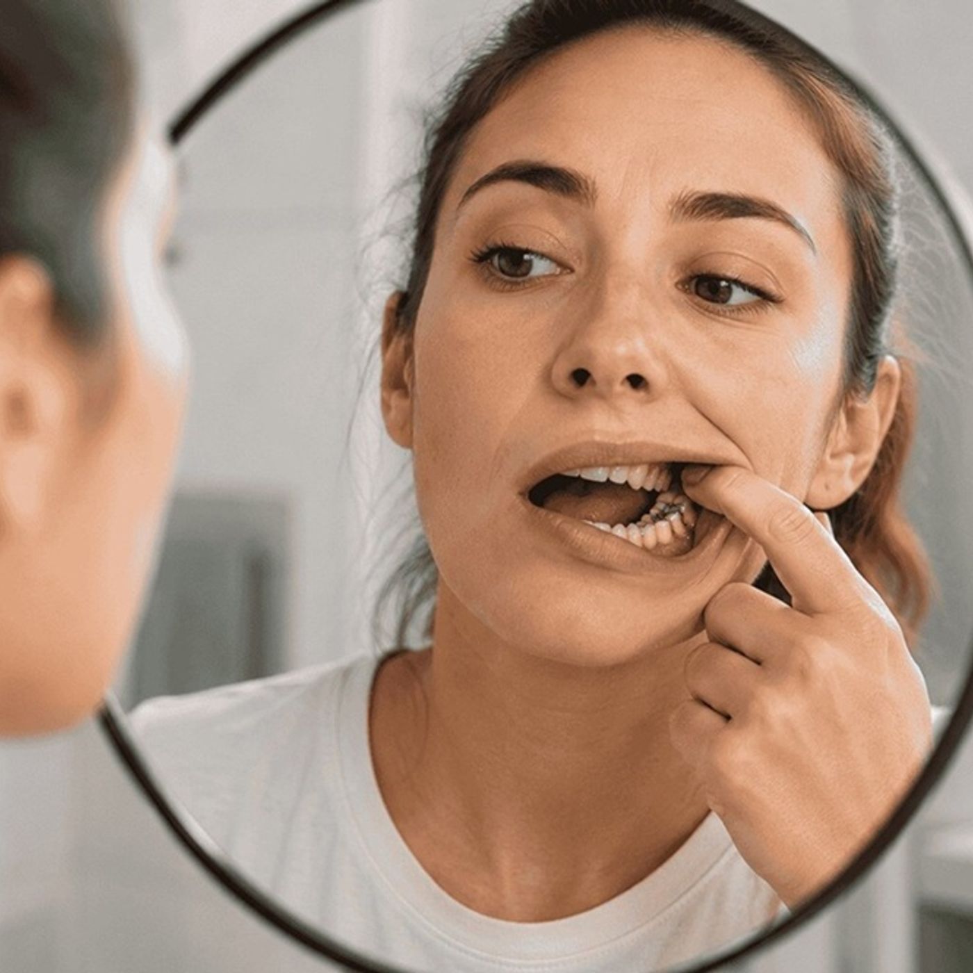 What’s Hiding Under Your Old Dental Fillings
