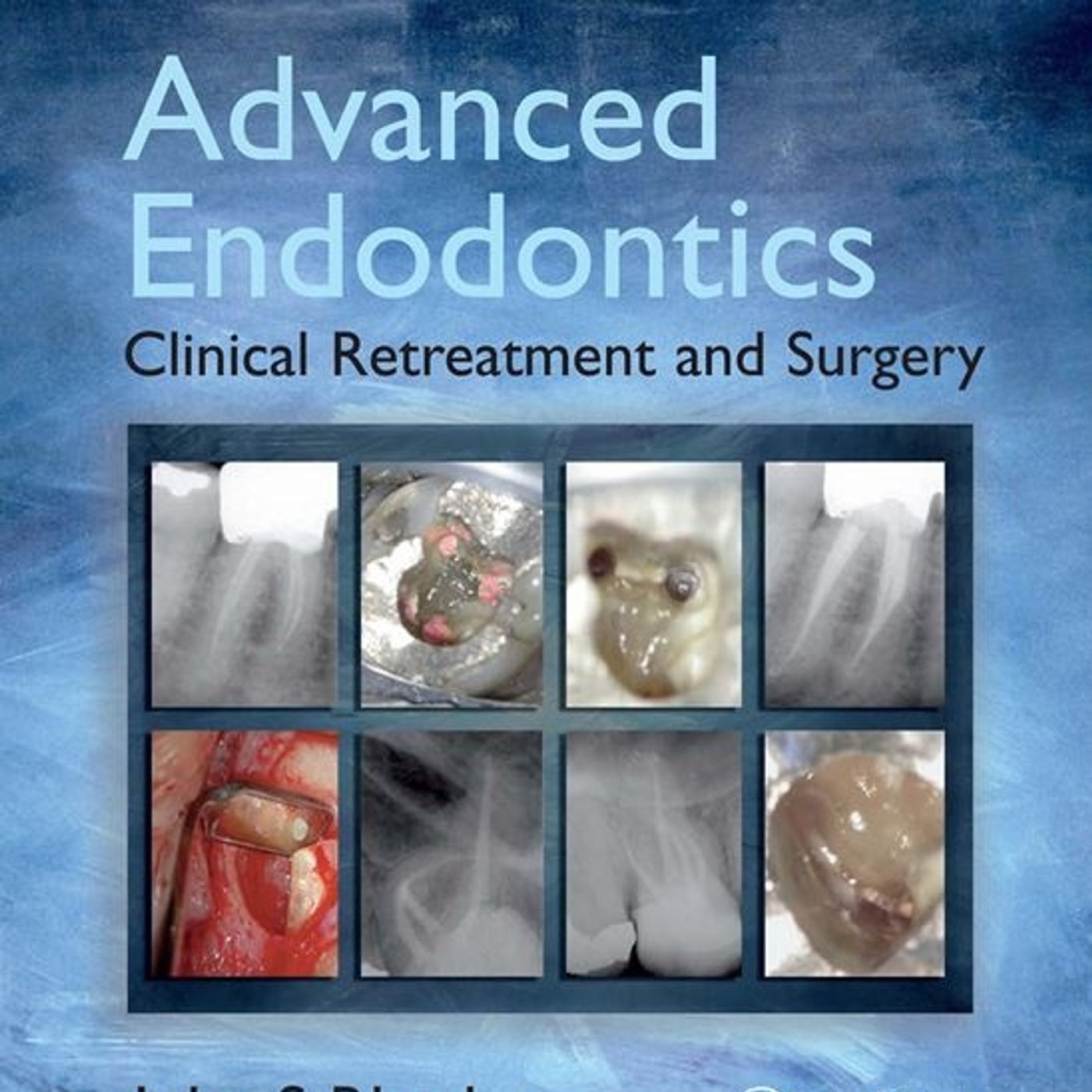 Advanced Endodontics