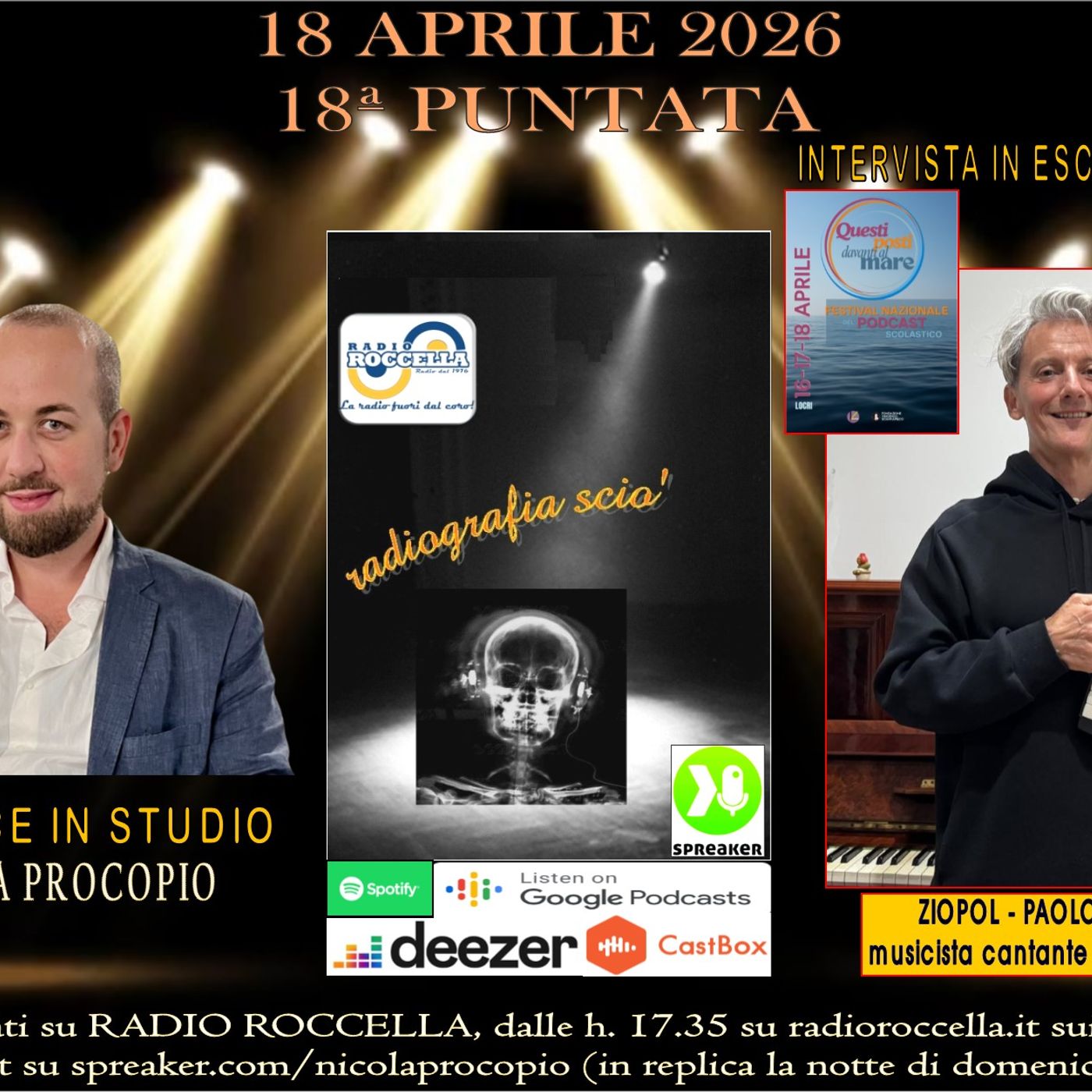 Radiografia Scio' - N.18 del 18-04-2026 episode artwork