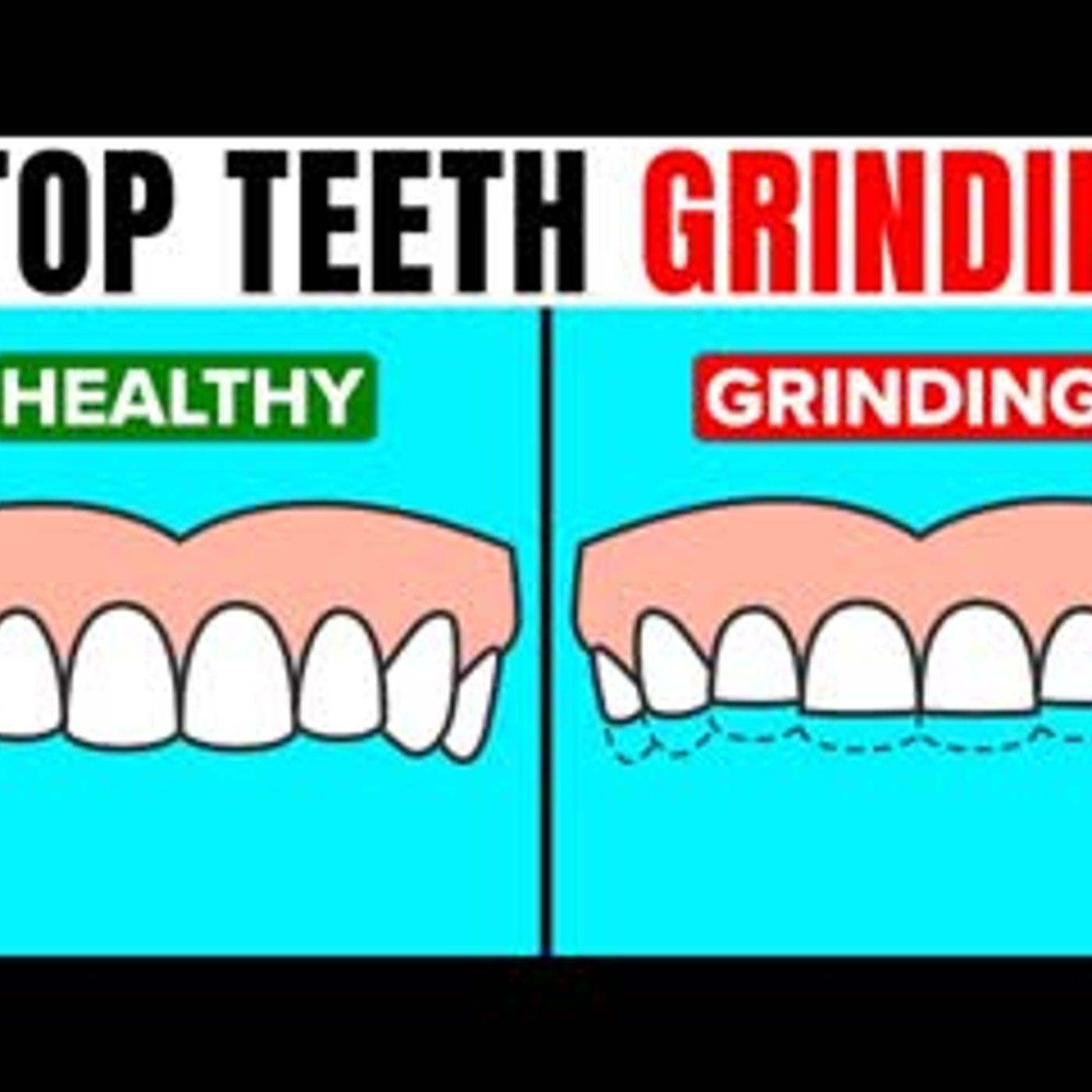 10 Effective Tips To Stop Grinding Your Teeth episode artwork