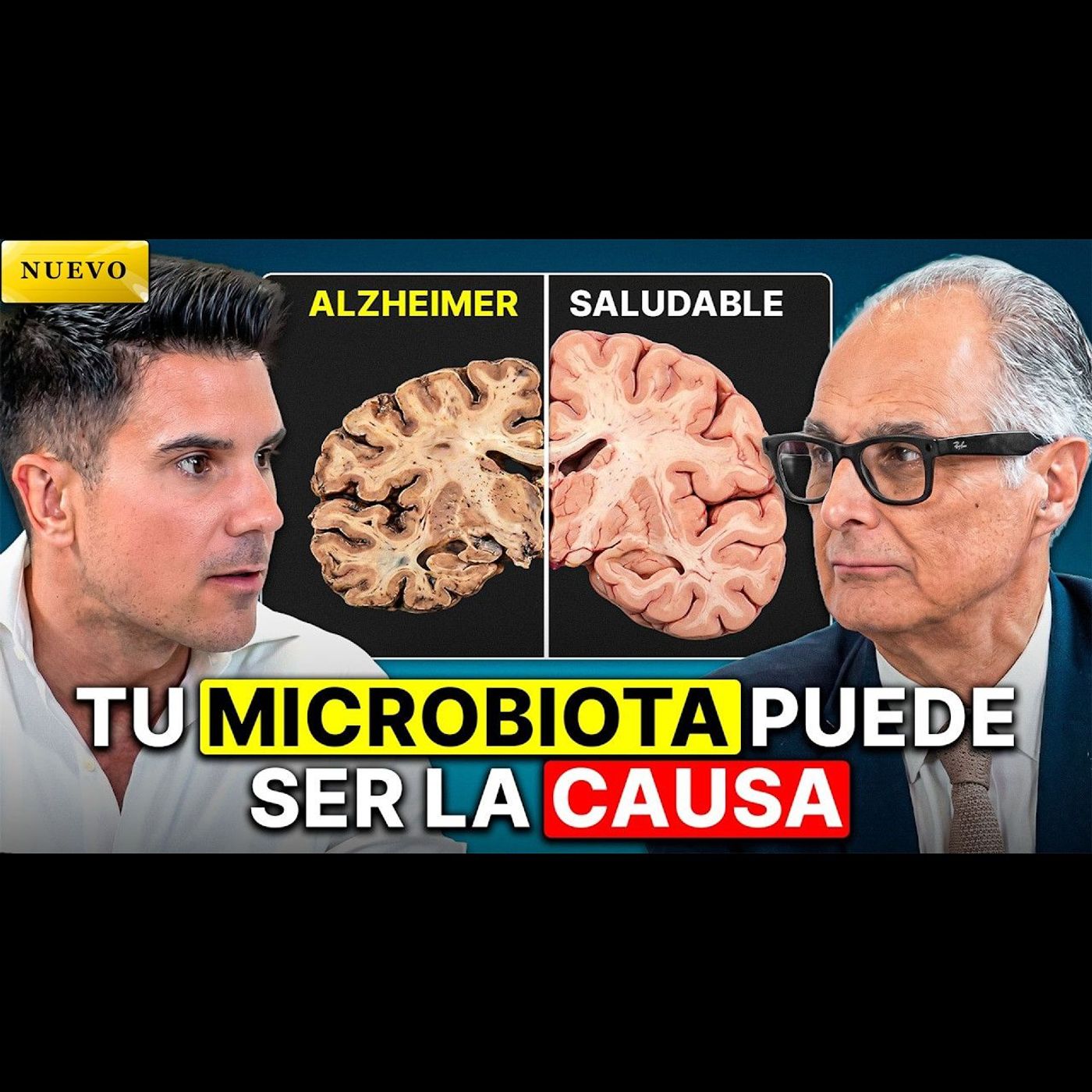 Catedrático de Fisiología: ¡La Demencia Empieza en tu Plato!