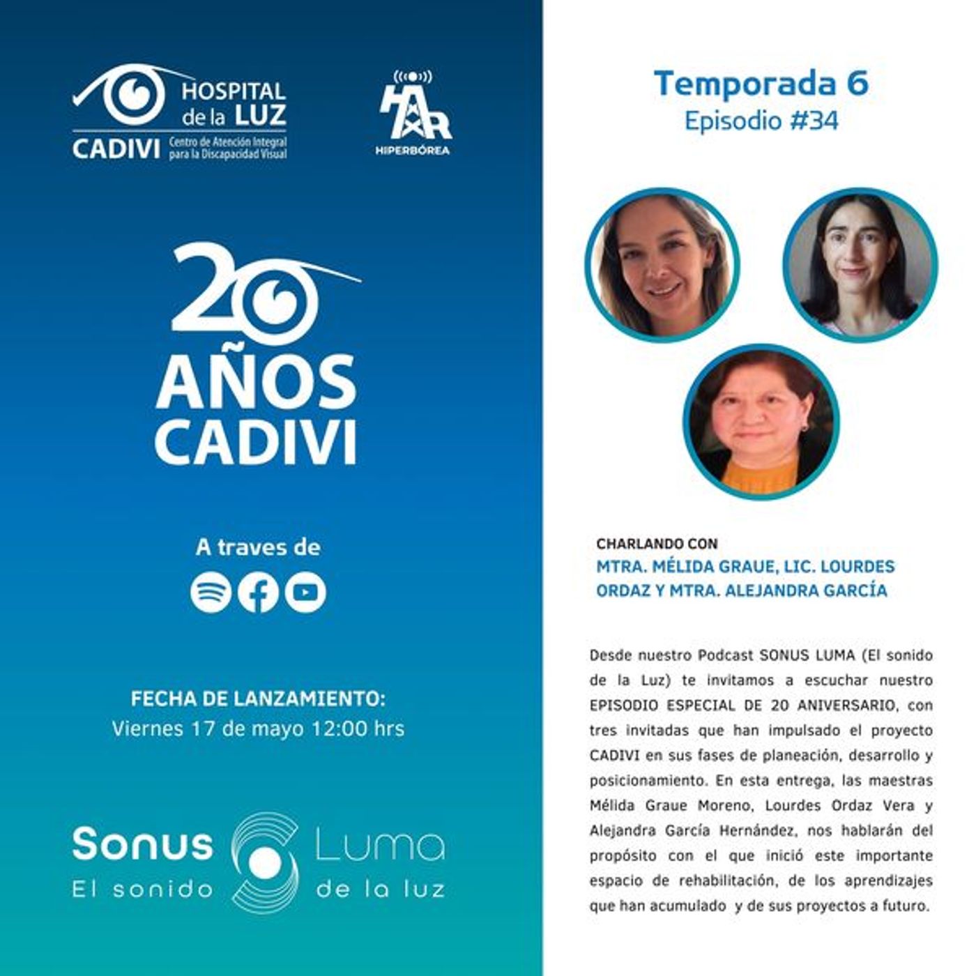 Sonus Luma