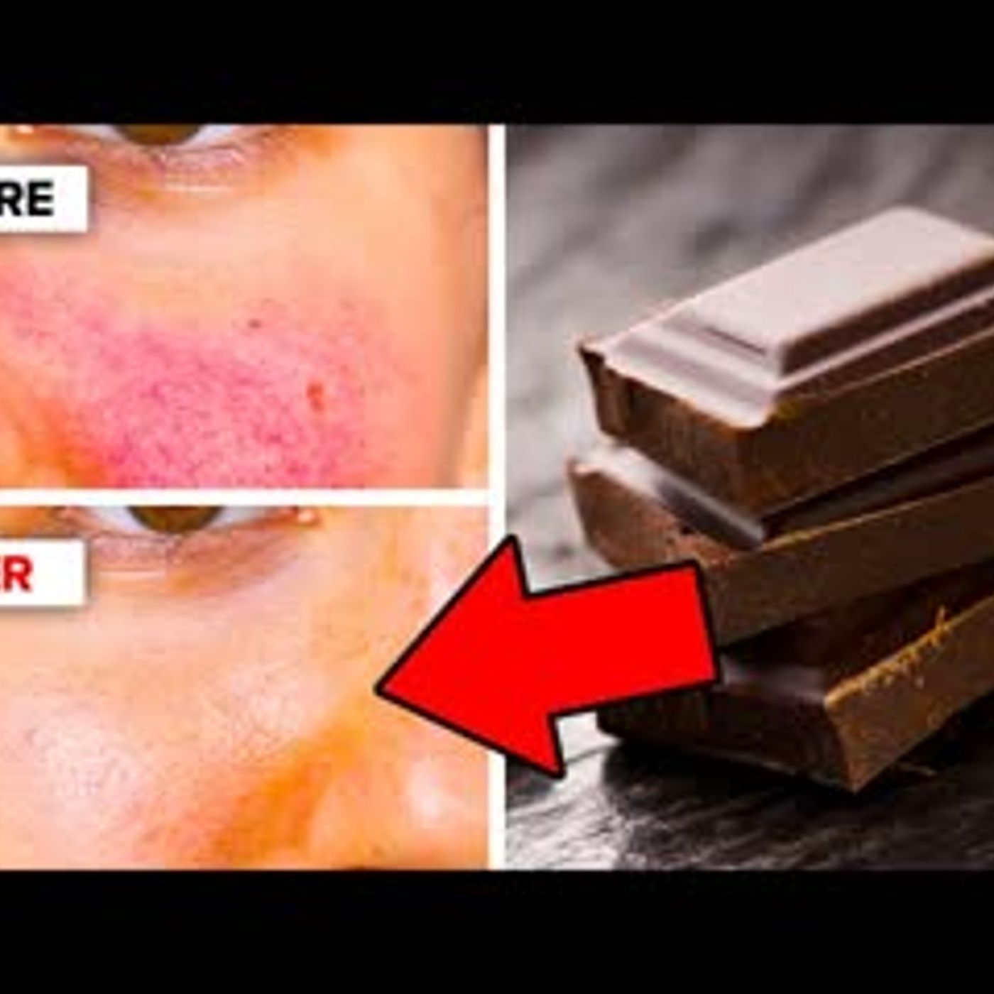 12 Best Foods For Healthy Skin episode artwork