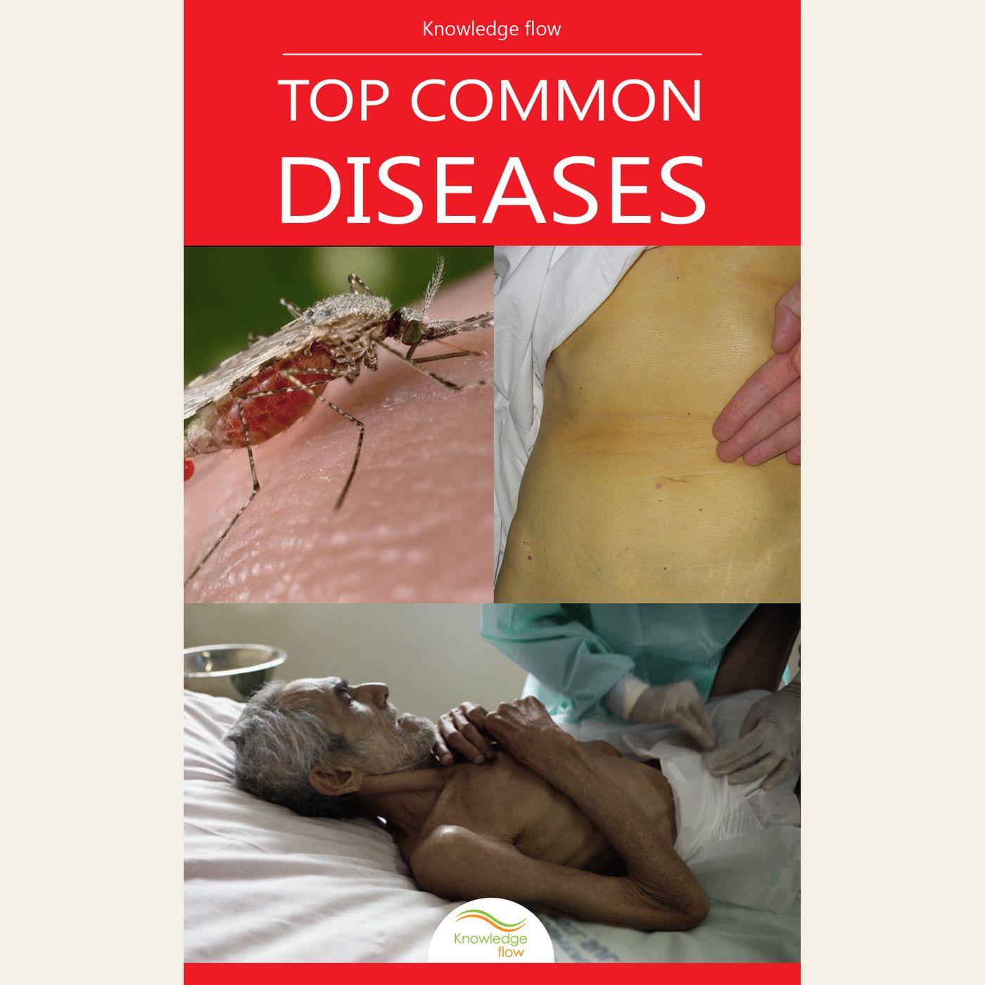 Common Diseases & Symptoms: Causes, Transmission & Prevention