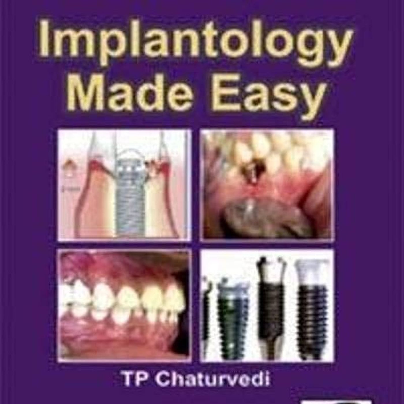 Implantology Made Easy