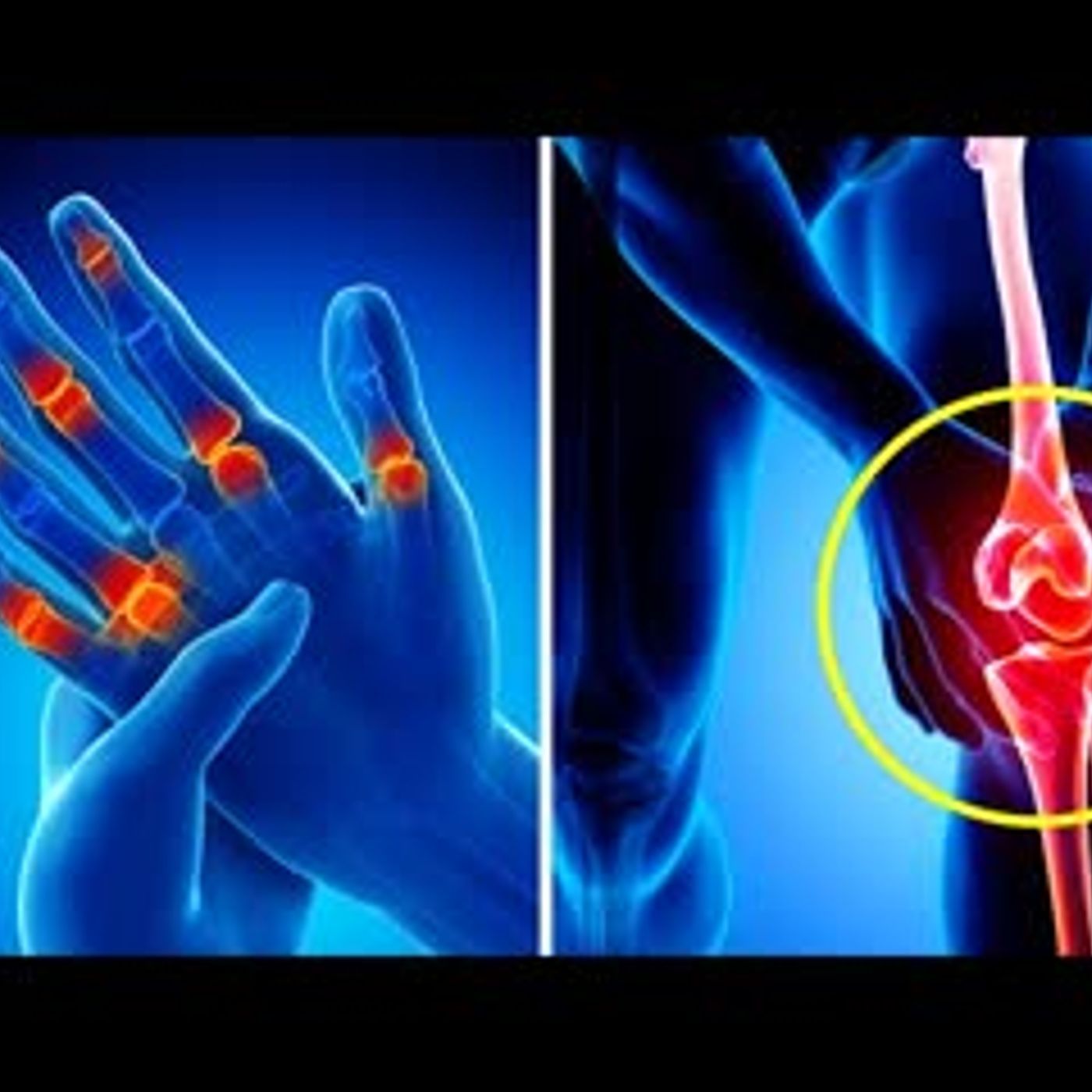 10 Reasons Your Joints Hurt All the Time episode artwork