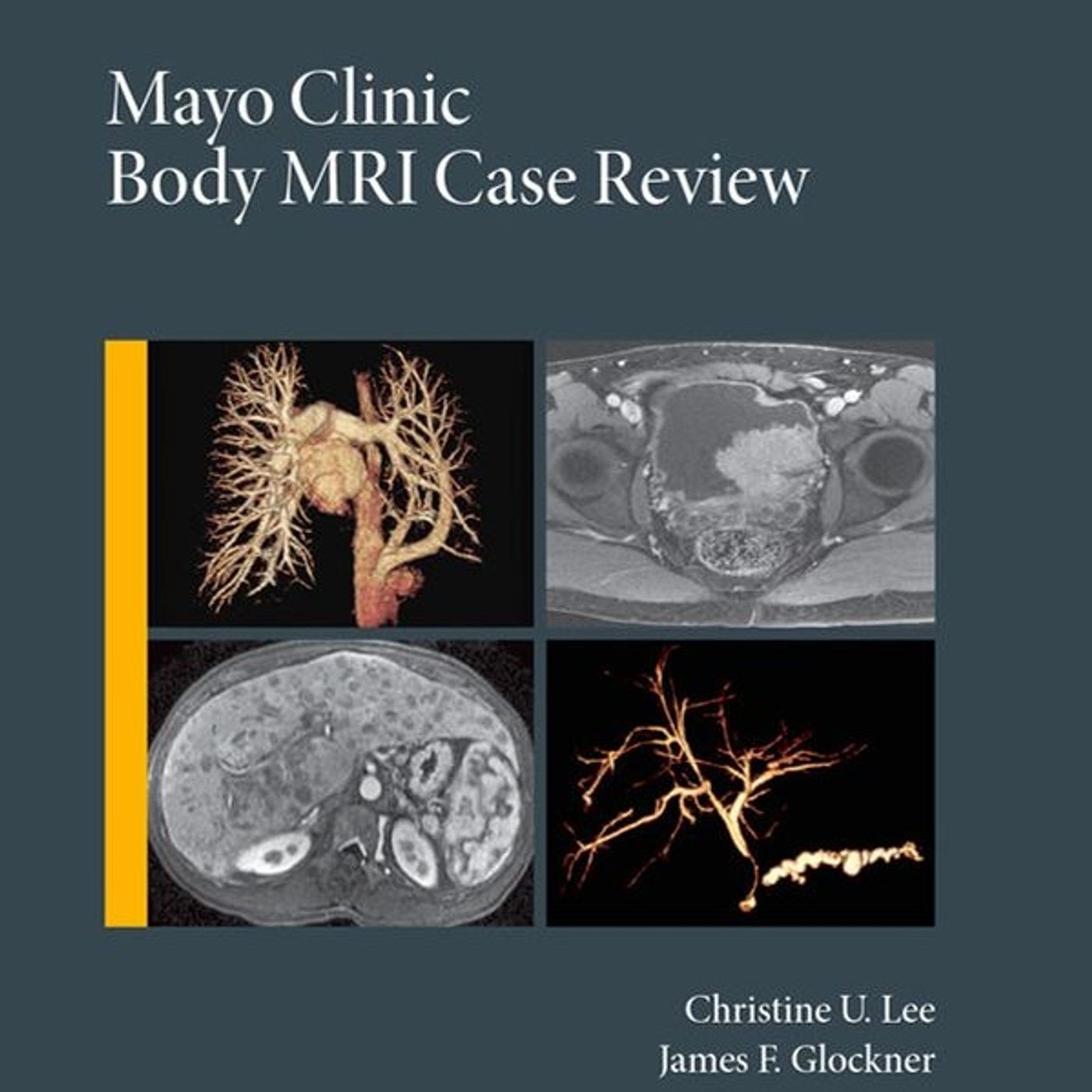 Mayo Clinic Body MRI Case Review