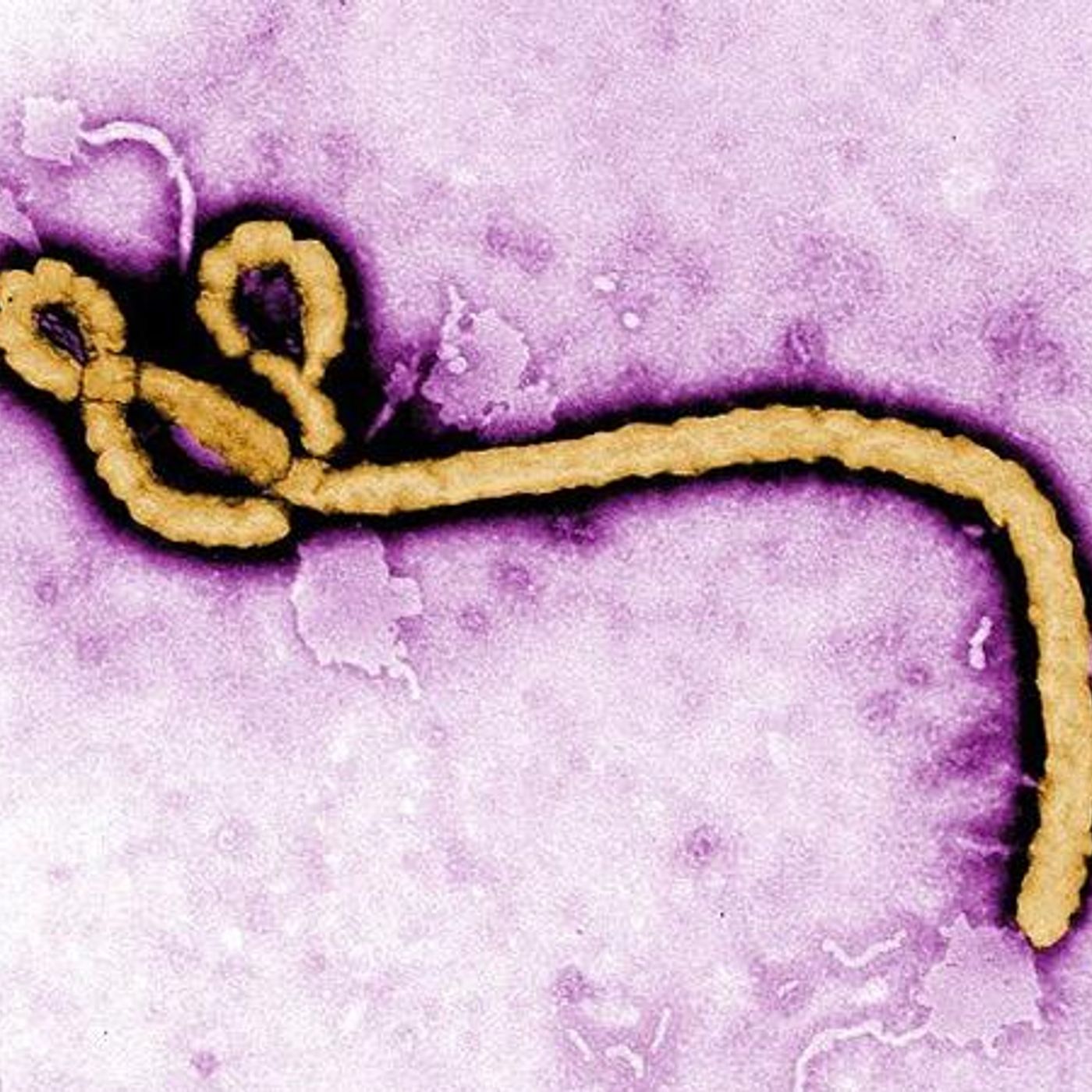 Survival Medicine Hour: James Wesley, Rawles; Ebola in the U.S.