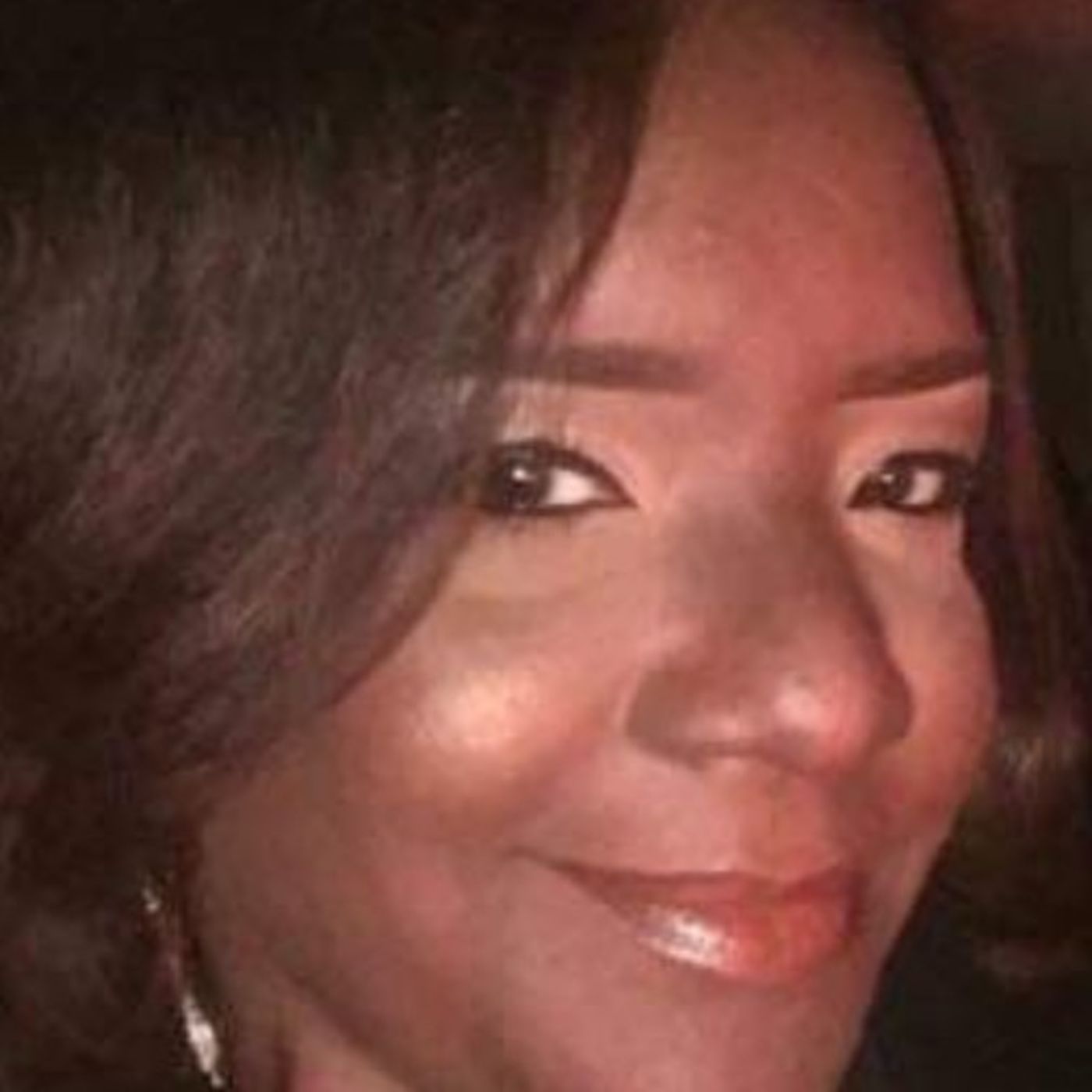 Susan Hendrix My Story Living With Lupus