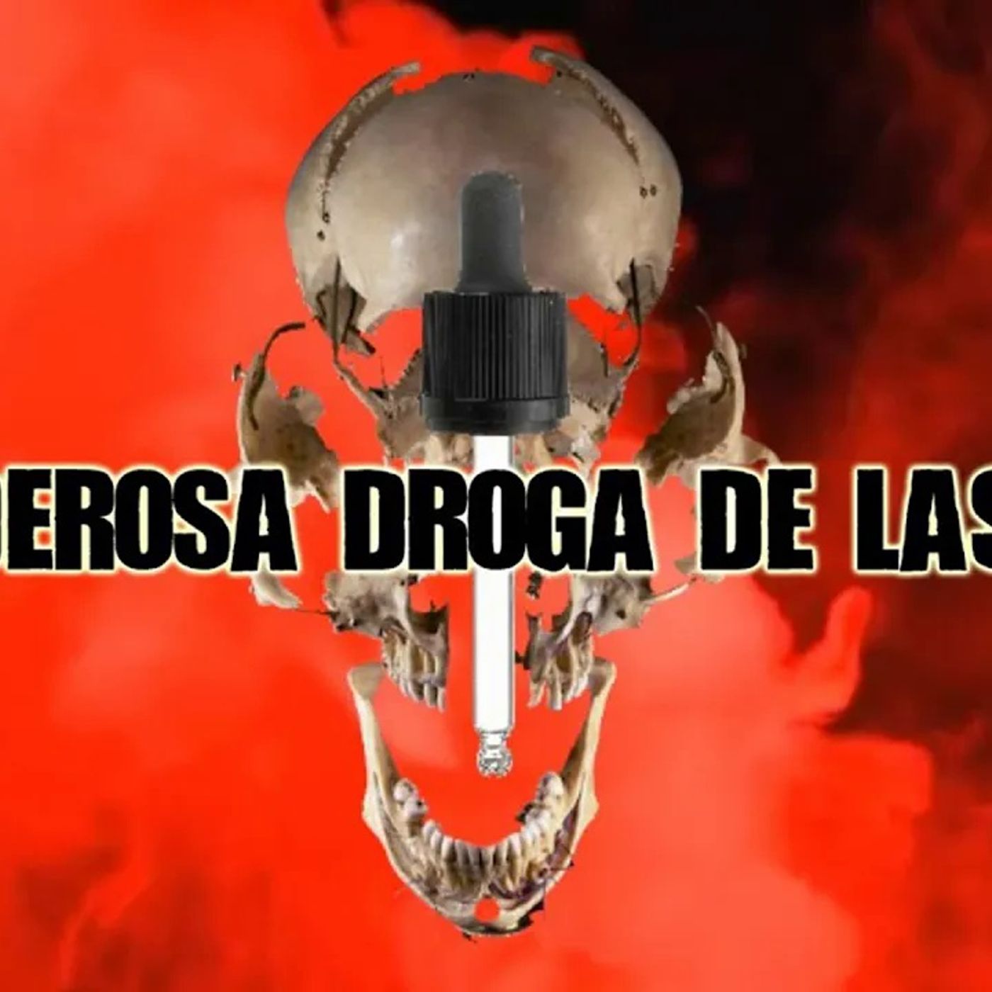 El Podcast de DrossRotzank