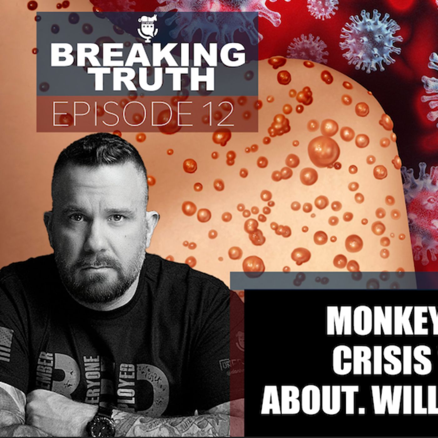 Breaking Truth: Monkeypox is now the latest crisis we all shouldn’t care about. Will liberals allow that? episode artwork