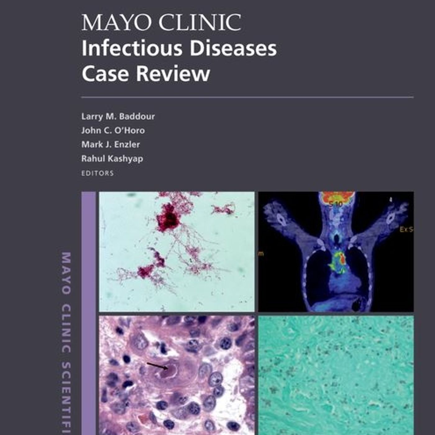 Mayo Clinic: Infectious Diseases Case Review