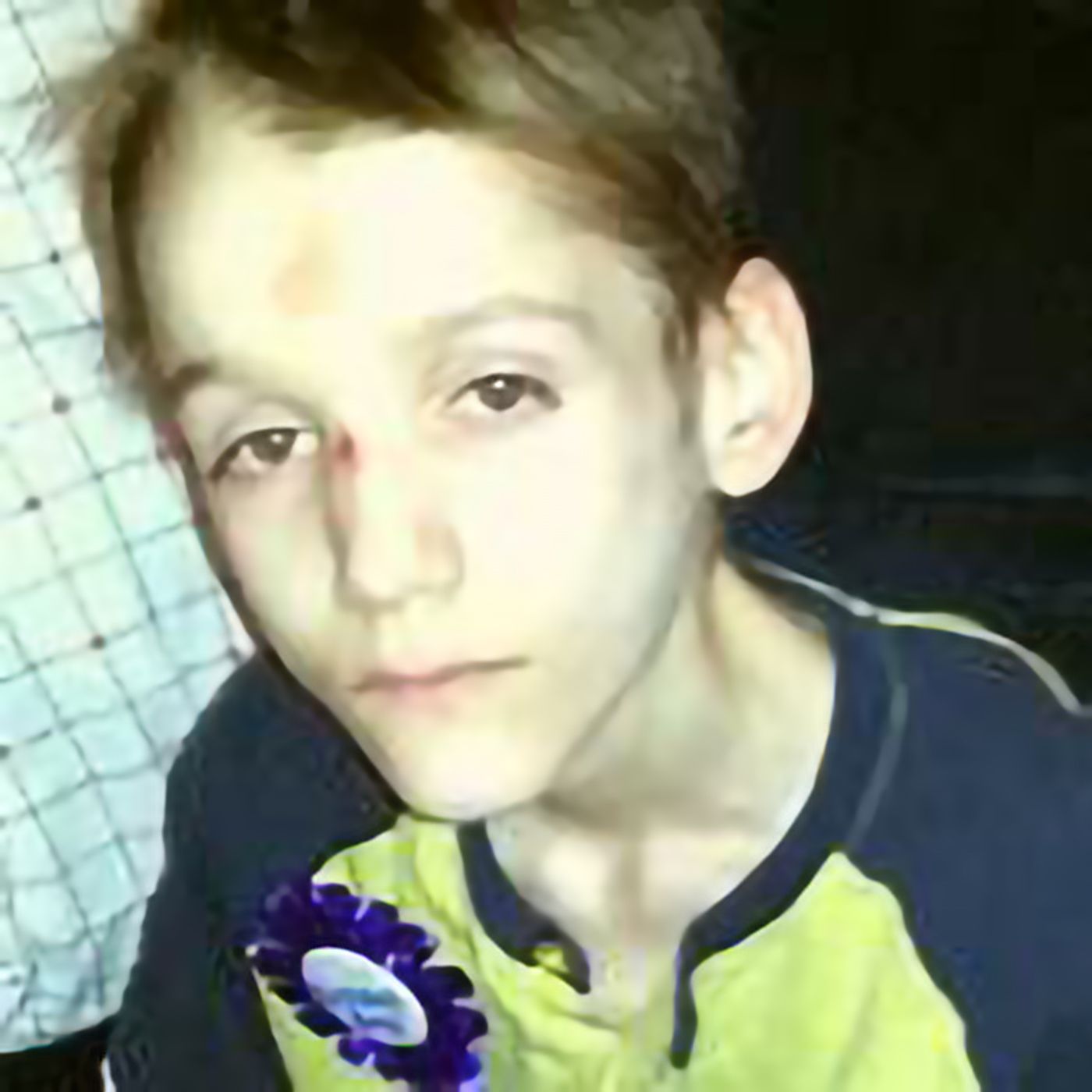 Burned Alive And Little Boy Lost