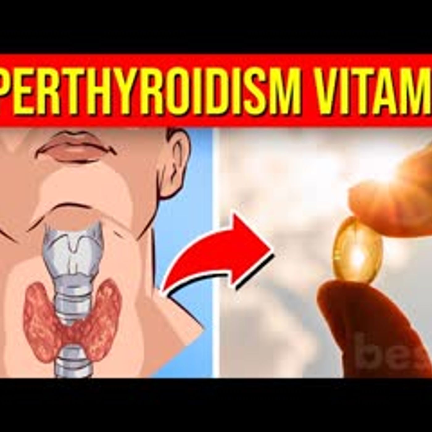 10 POWERFUL Vitamins & Minerals For Hyperthyroidism episode artwork