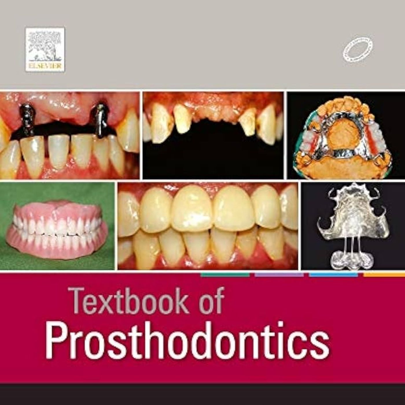 Textbook of Prosthodontics