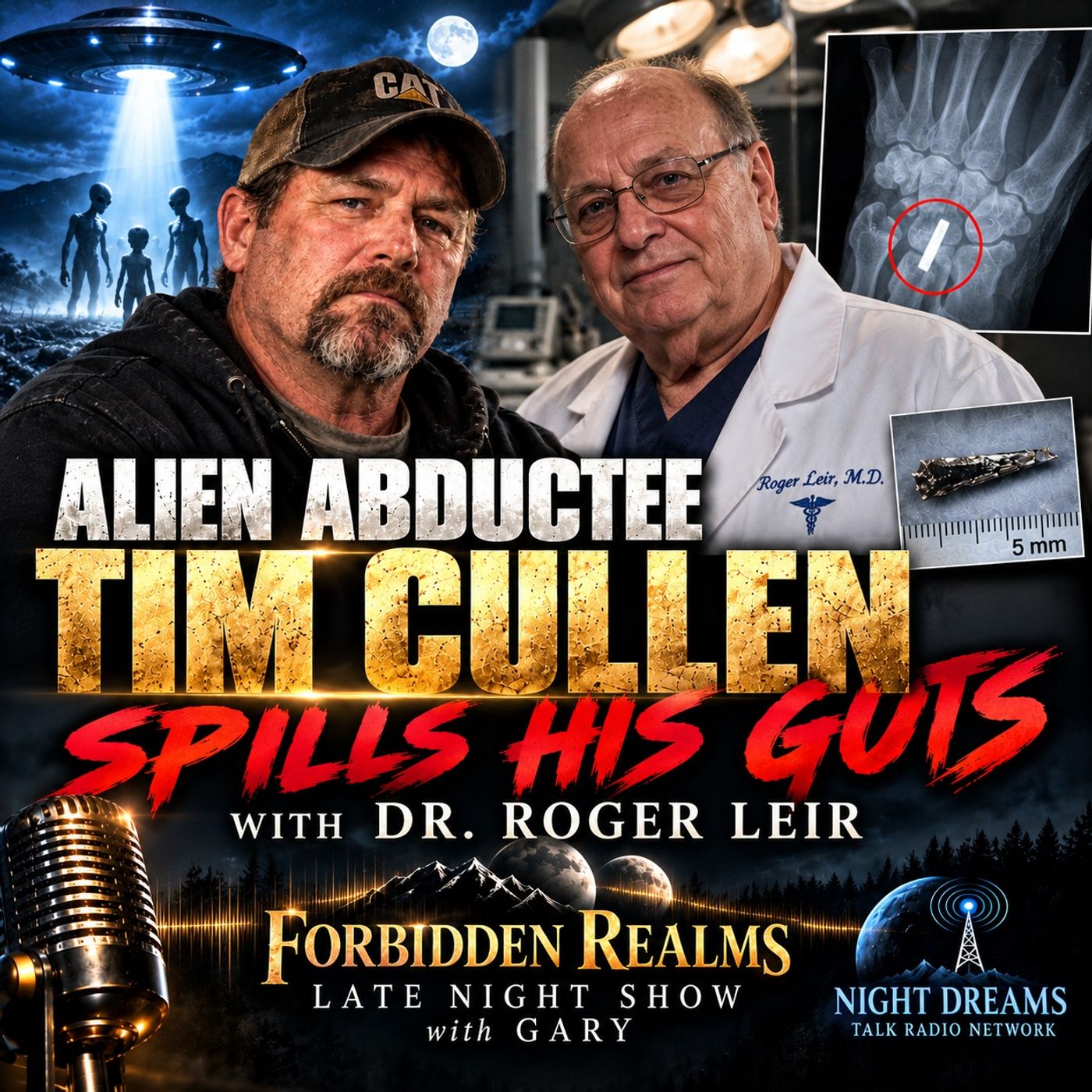 Timothy Cullen Spills The Beans Alien Implant Removed By Dr. Roger Leir episode artwork