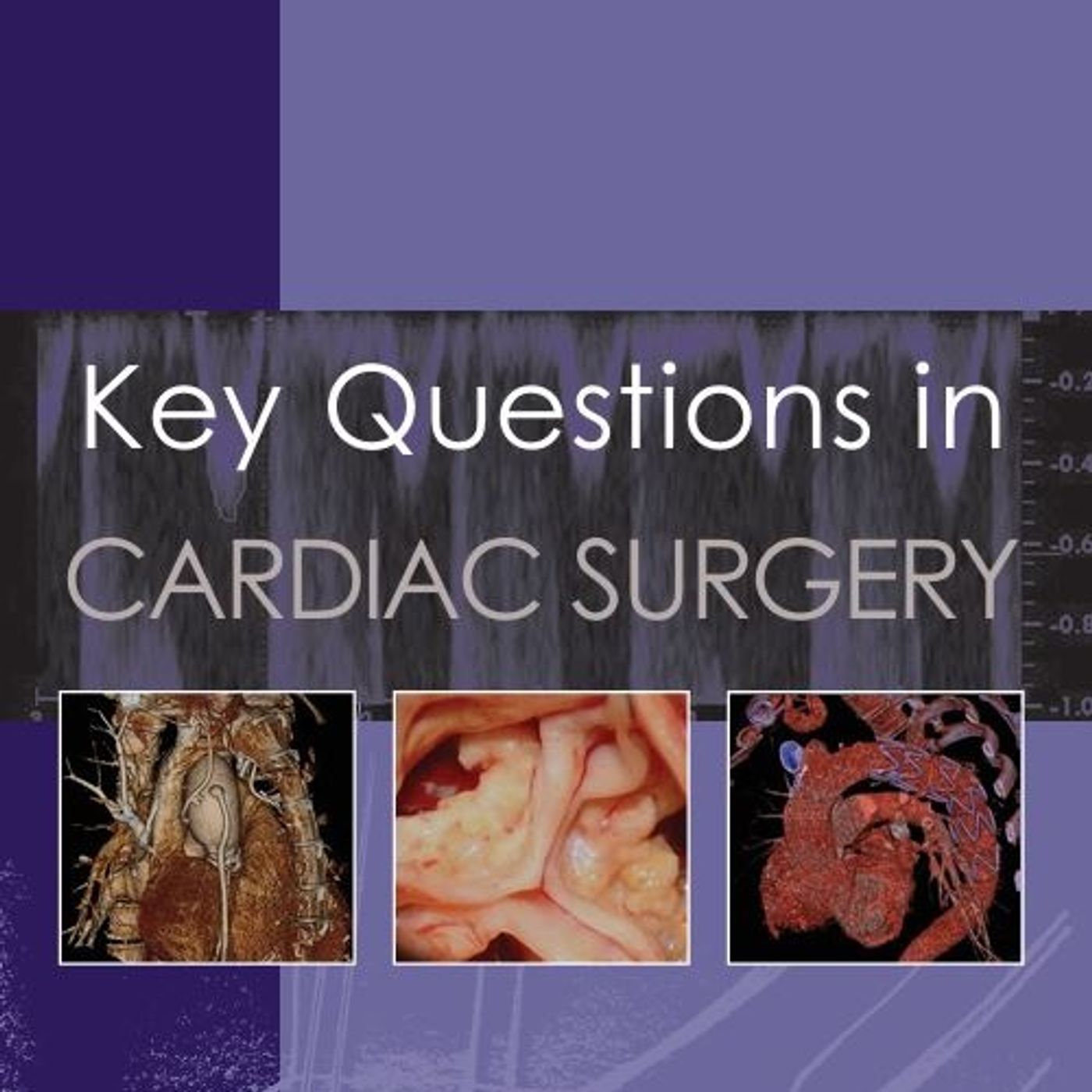 Key Questions in Cardiac Surgery