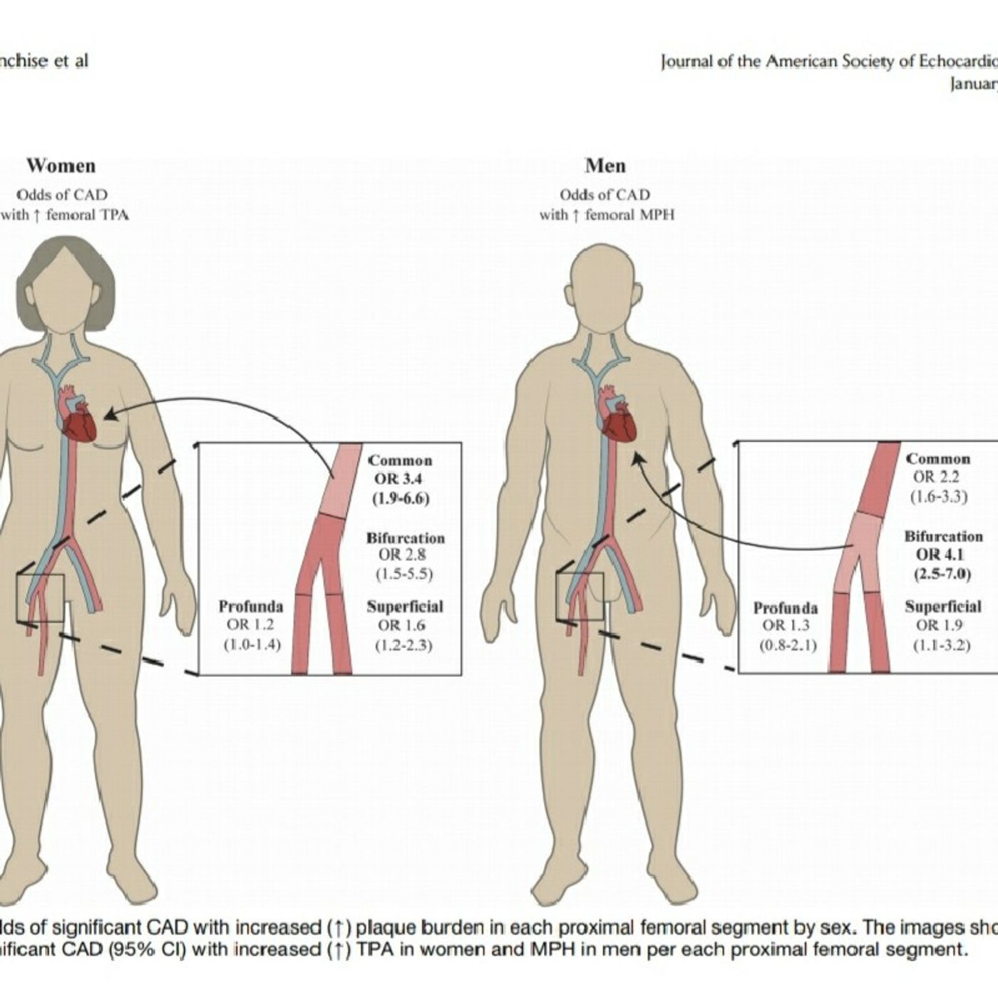 WOMEN & Cardiovascular Screening. Colledanchise et al. JAN 2020 Vol 33 No 1 pp90-100