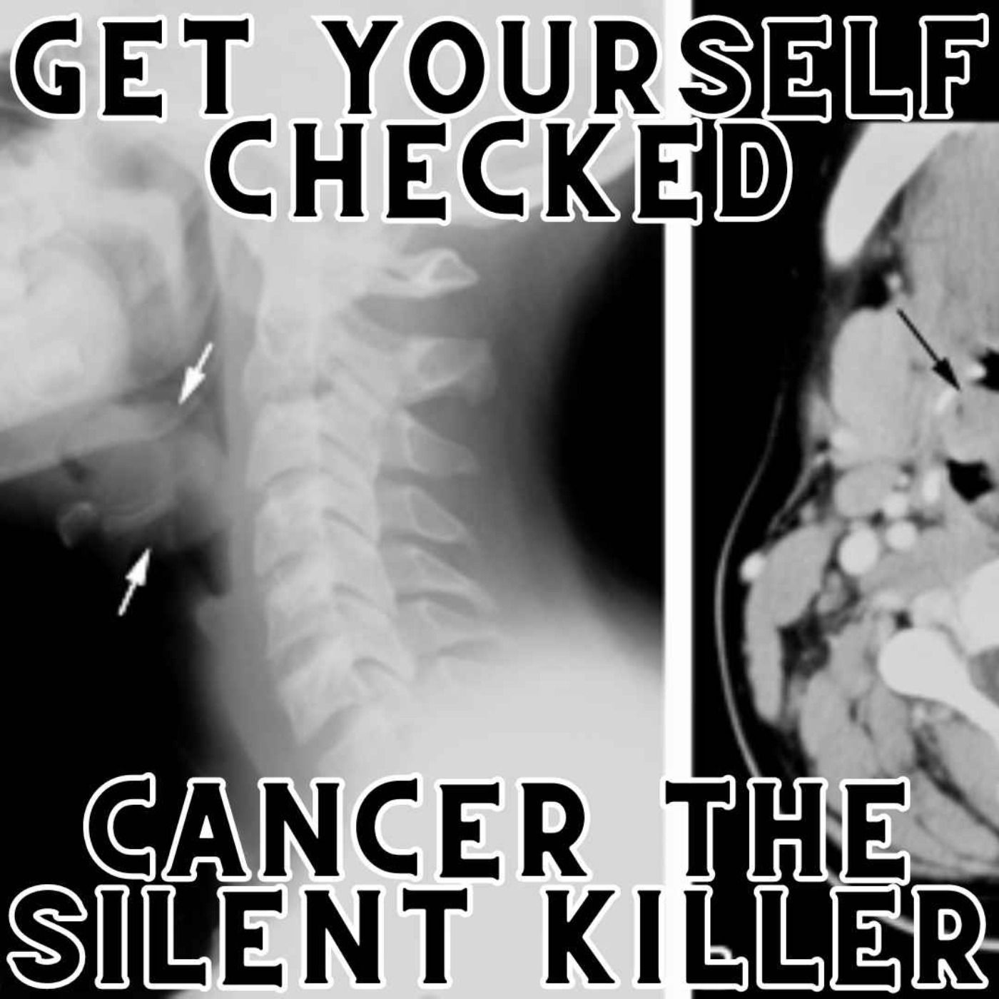 Get Yourself Checked, Cancer Is A Silent Killer