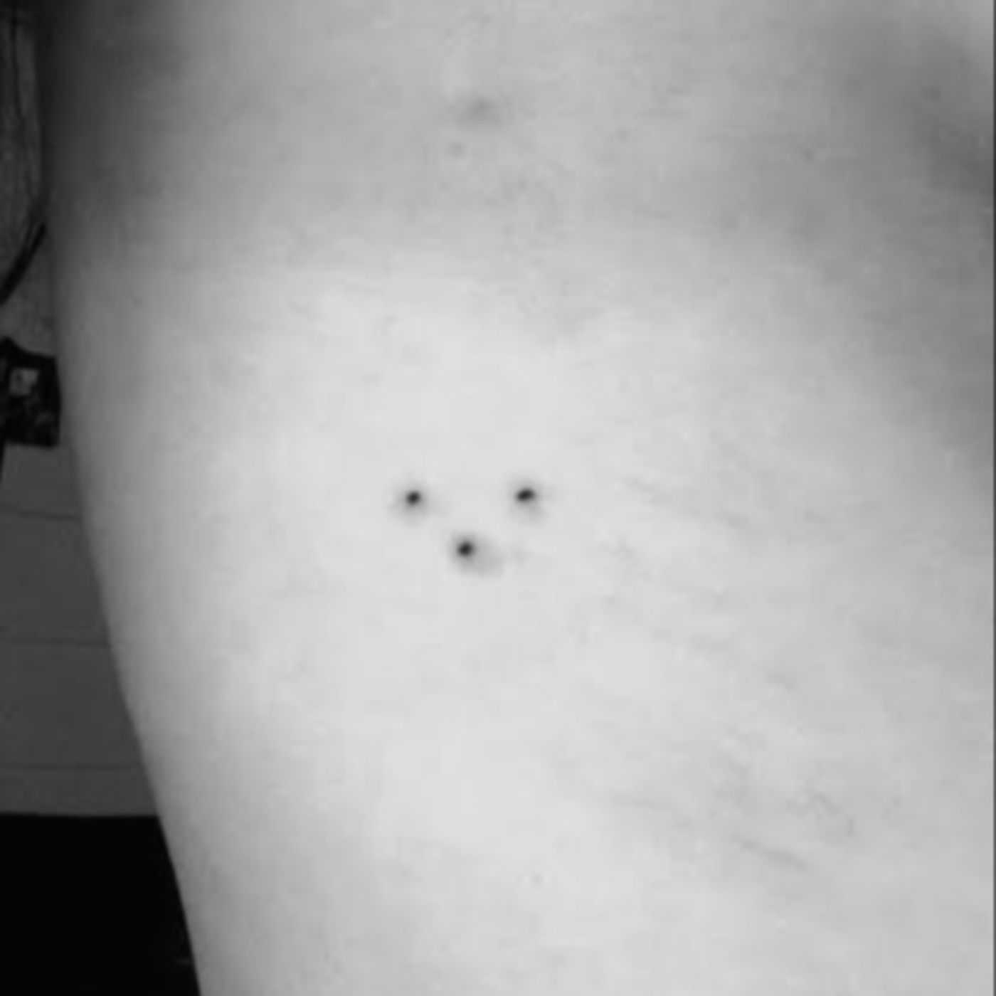 RED TRIANGLE MARKS IN ALIEN ABDUCTIONS/CATTLE MUTILATIONS - "WATCH THE RED DOTS!" episode artwork
